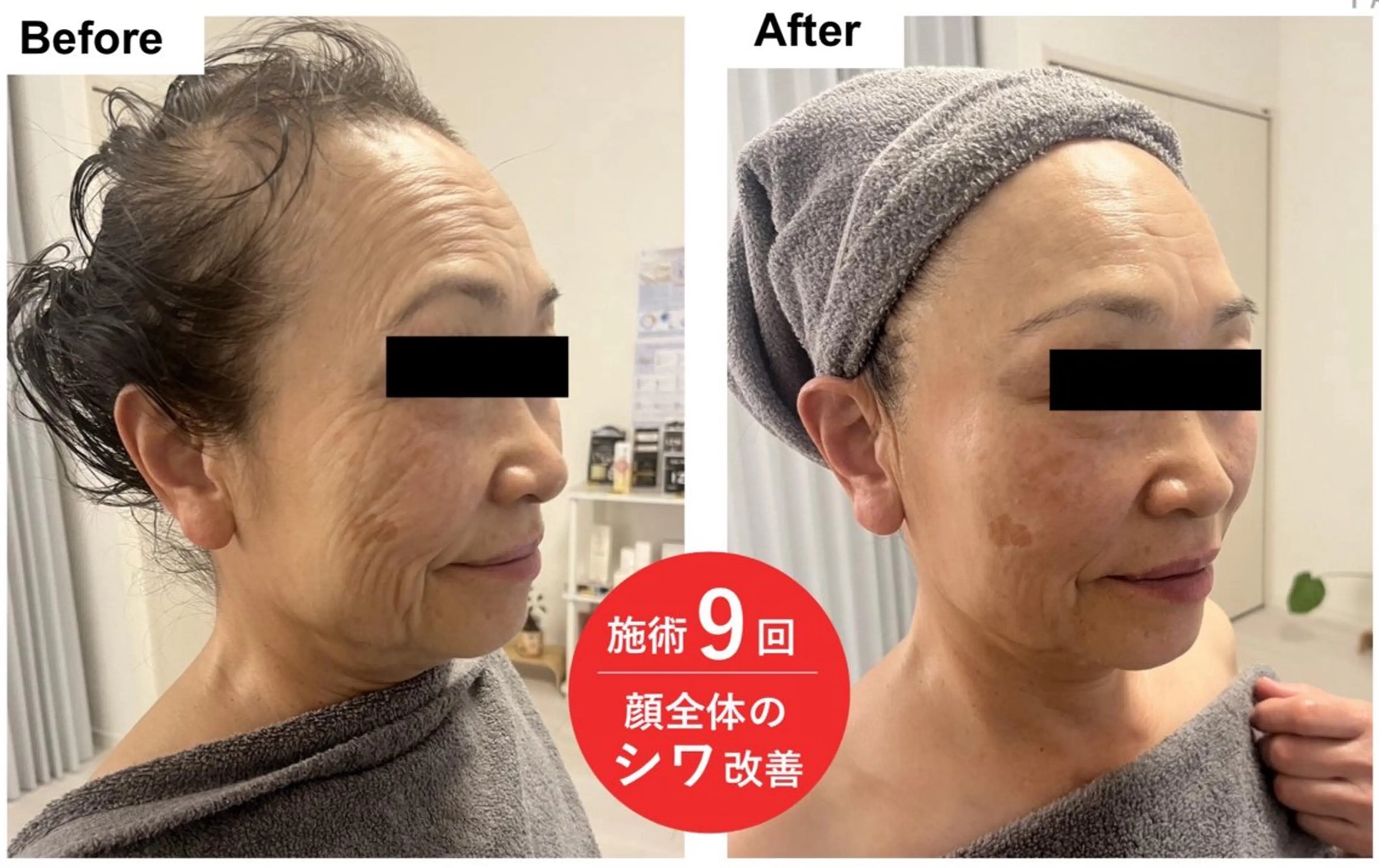 エステ 脂肪冷却/エステ COCOKARAのエステ・リラクイメージ