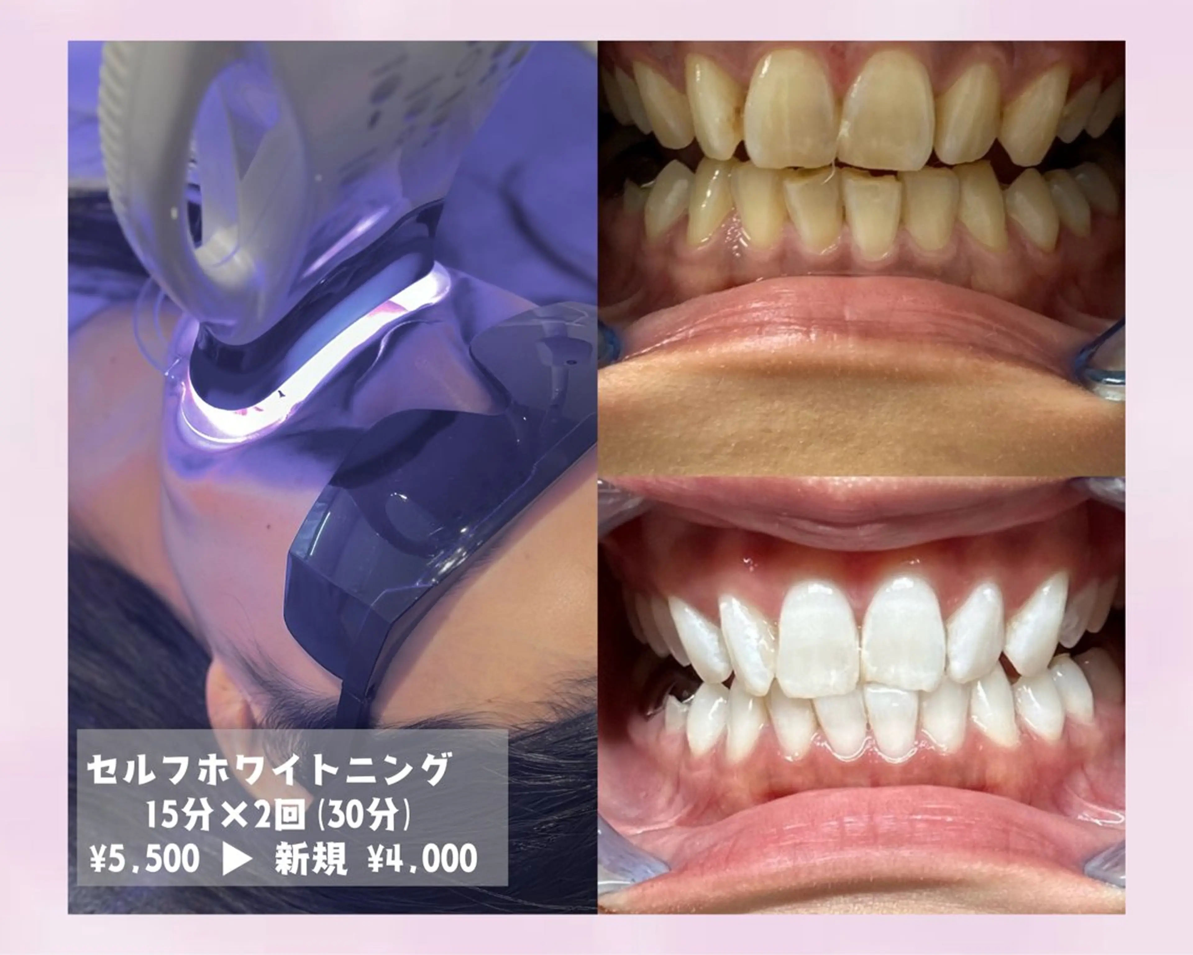 エステ リラク salon SHE° 新宿店🩵のその他イメージ