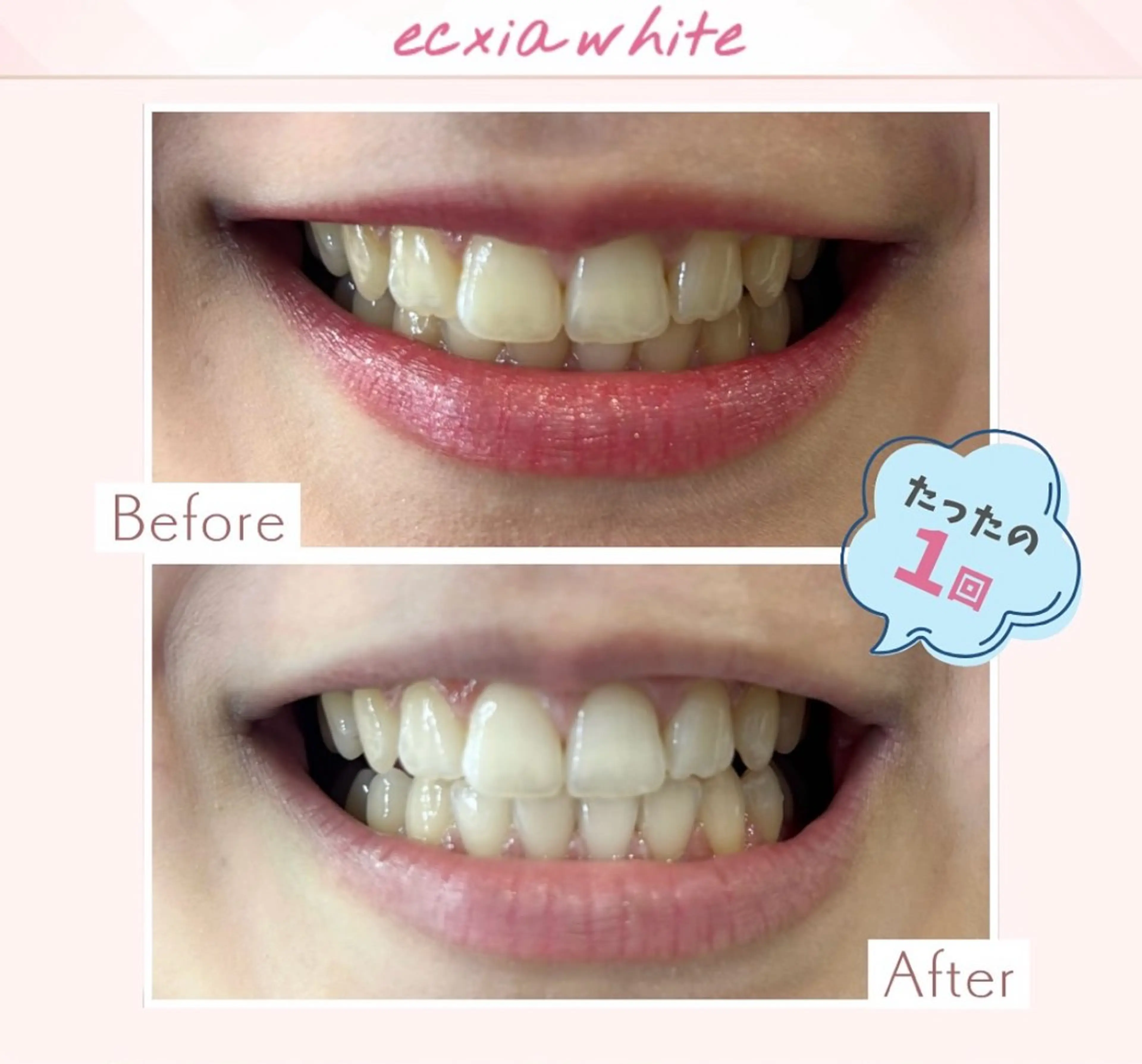 エクシアホワイト調布所属・セルフホワイトニング エクシア調布店のその他イメージ