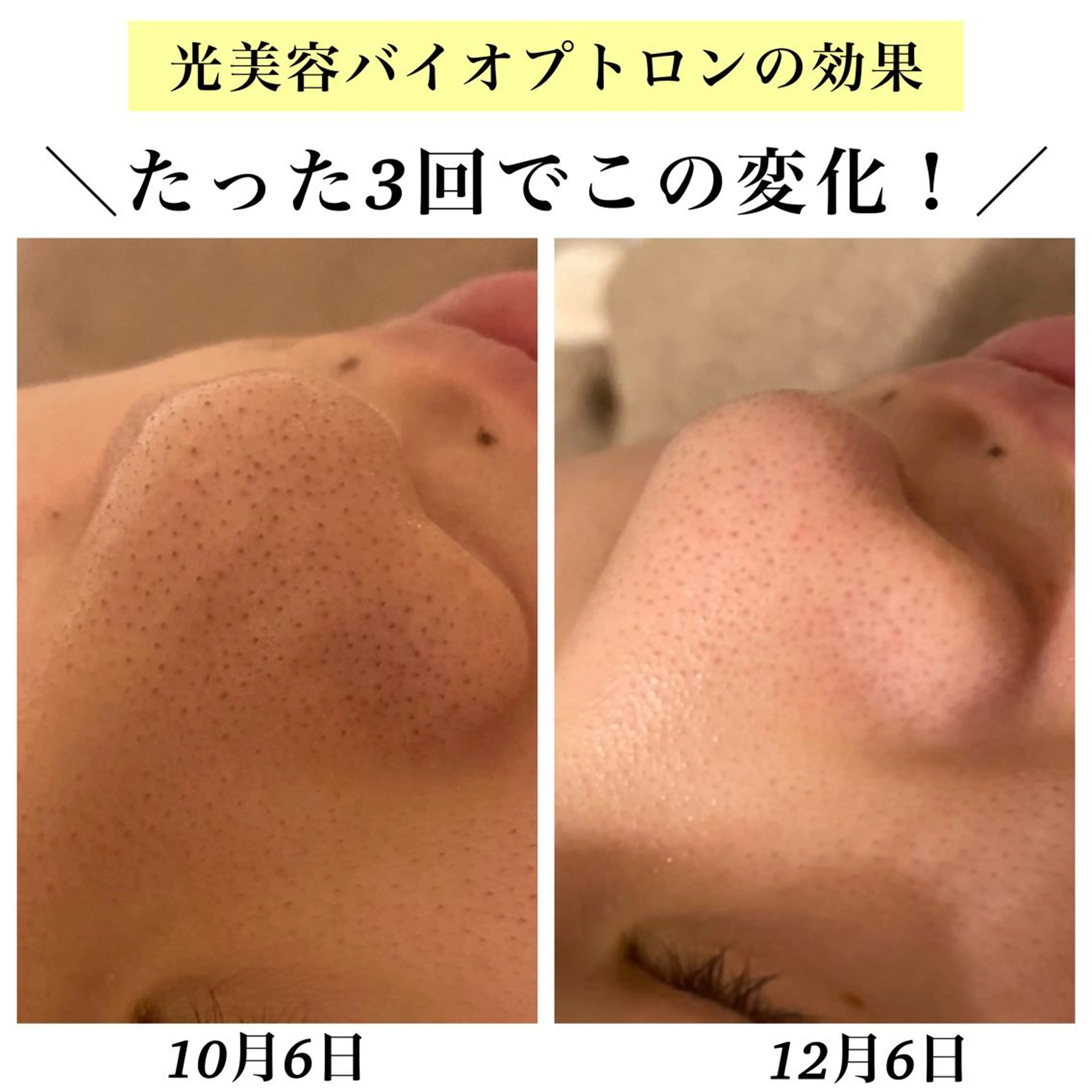 Bellesthe (ベルエステ)のエステ・リラクイメージ