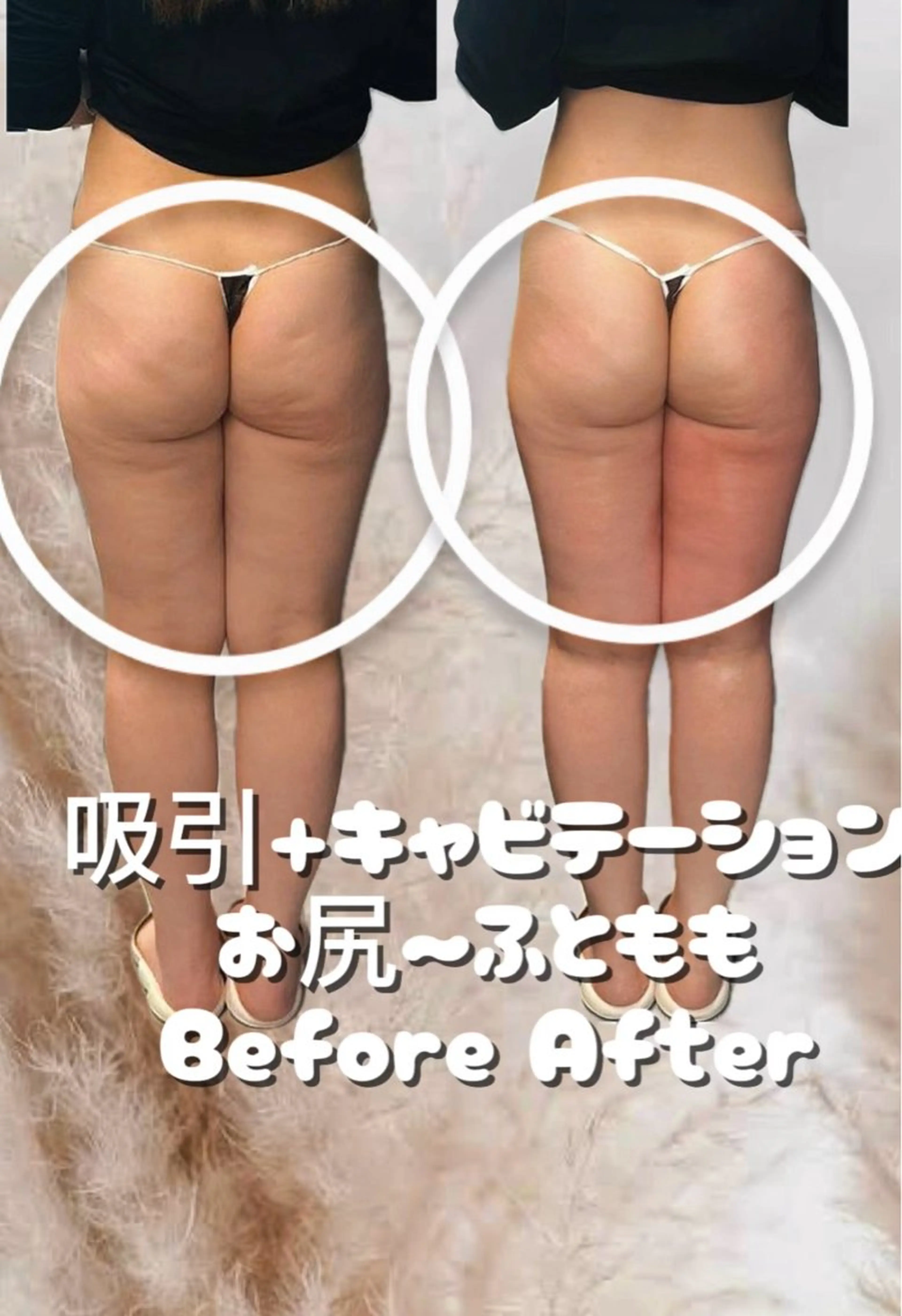 エステ リラク 美容整体・塗る漢方・フェイシャルRechica所属・心斎橋痩身 美肌整体サロン💓のエステ・リラクイメージ