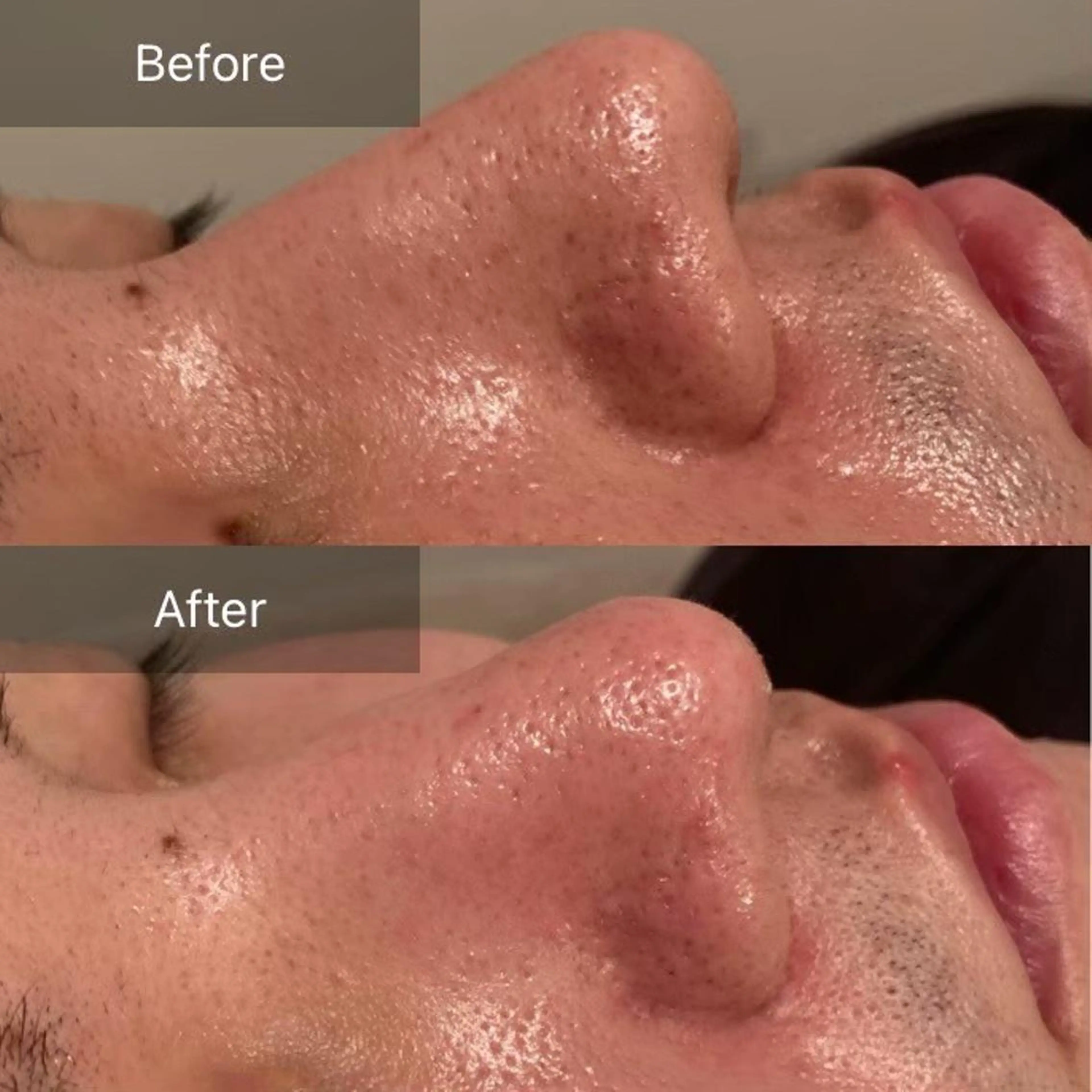 メンズ B&H所属・頭痛•肩こり専門/ 眉サロンB&H心斎橋のエステ・リラクイメージ