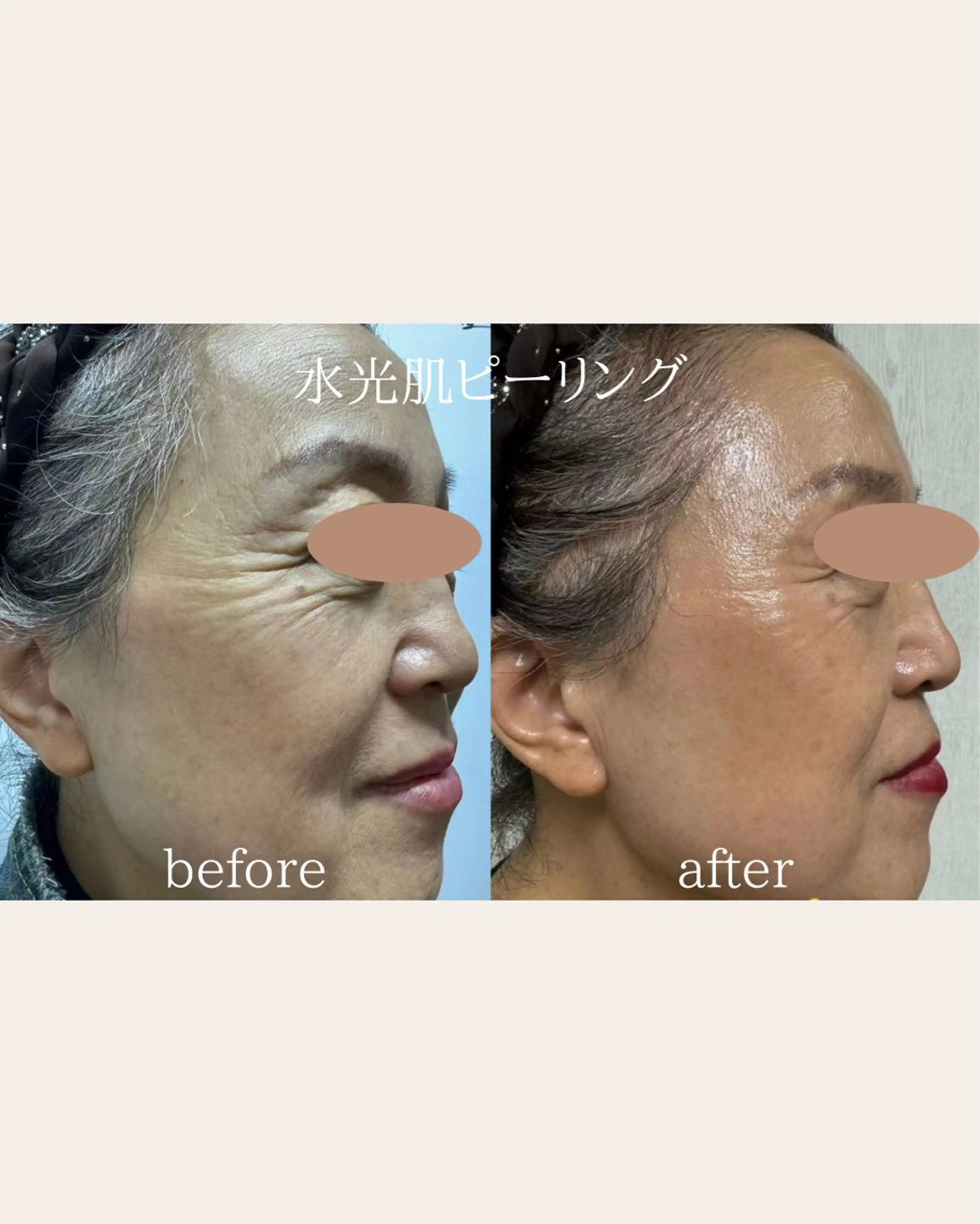 痩身/腸もみ/ ヘッドスパ/リンパのエステ・リラクイメージ