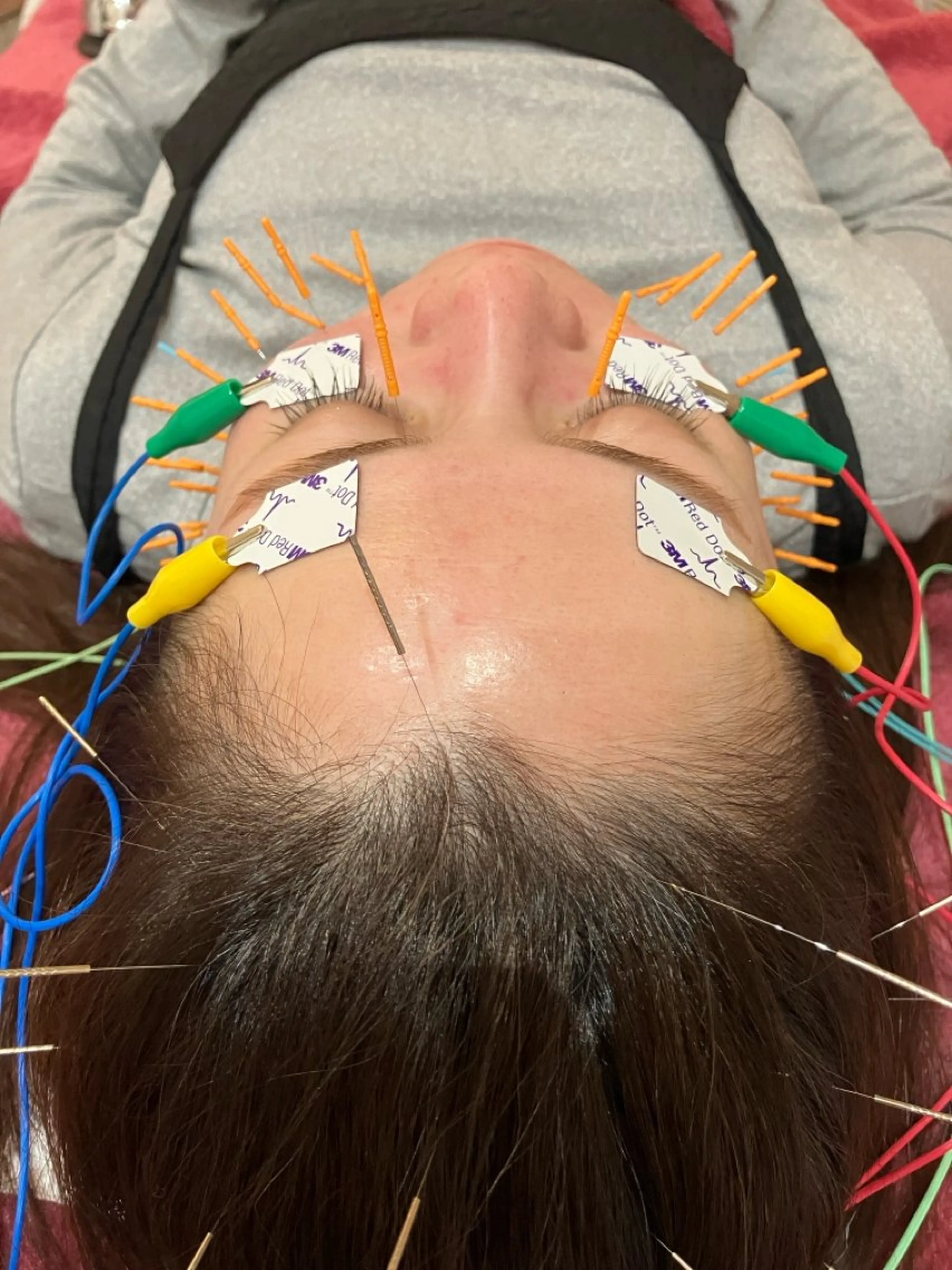 その他 美容鍼灸女性専用 りんご鍼灸治療院のその他イメージ