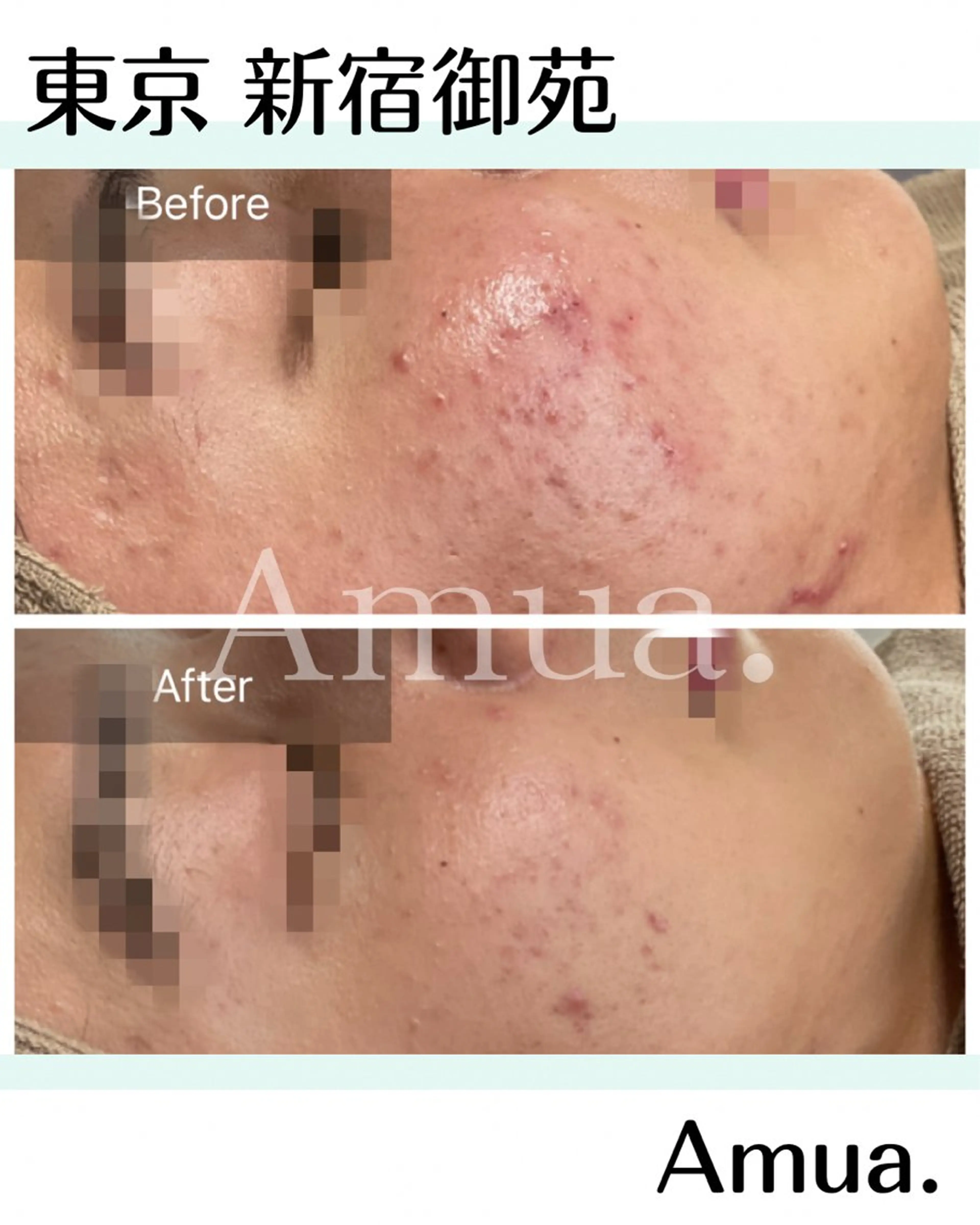 エステ Amua.facial salon所属・Amua.ハーブ 新宿御苑駅前のエステ・リラクイメージ