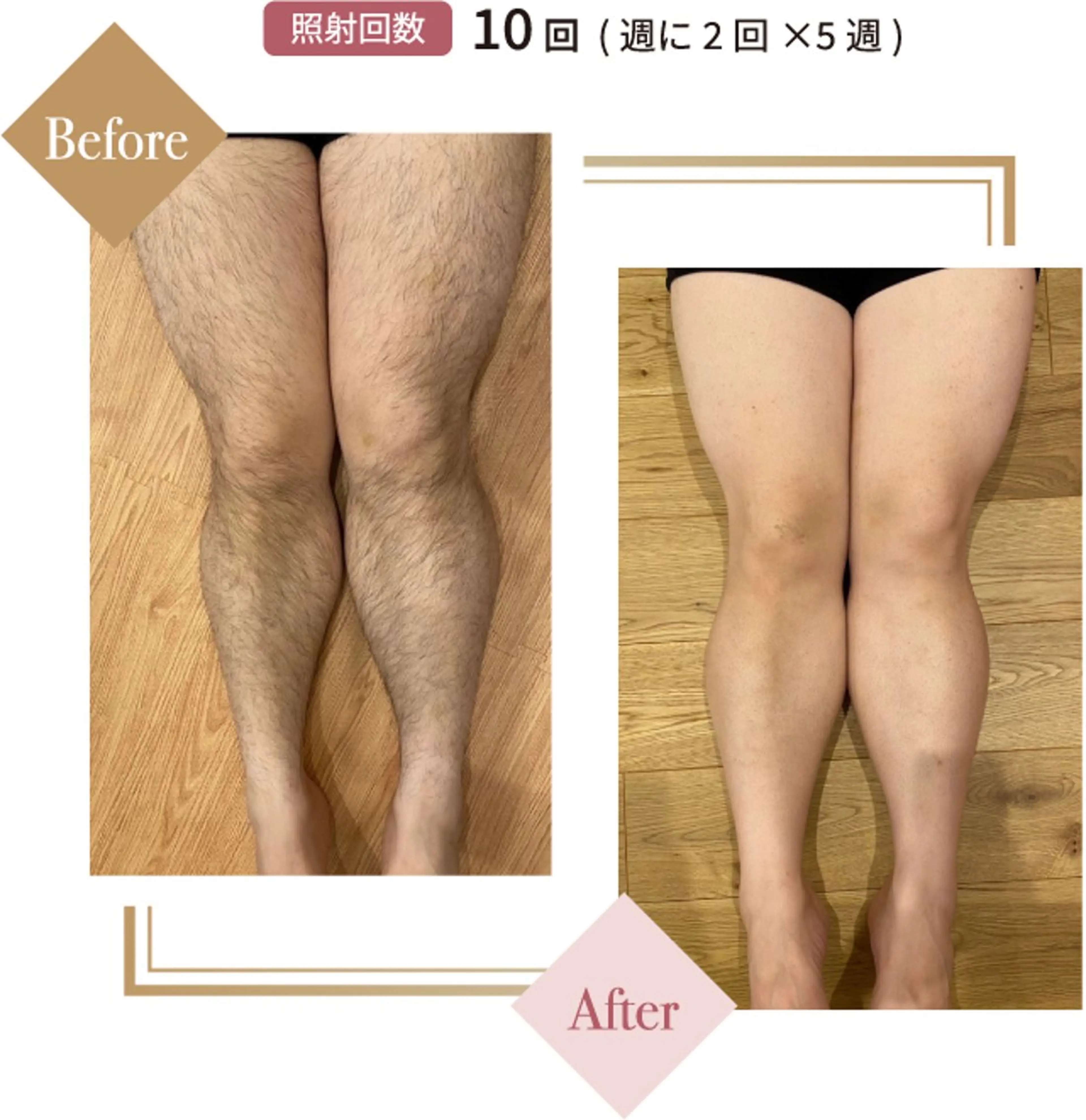 ニキビ、痩身、脱毛、 サクラチャンスパのエステ・リラクイメージ