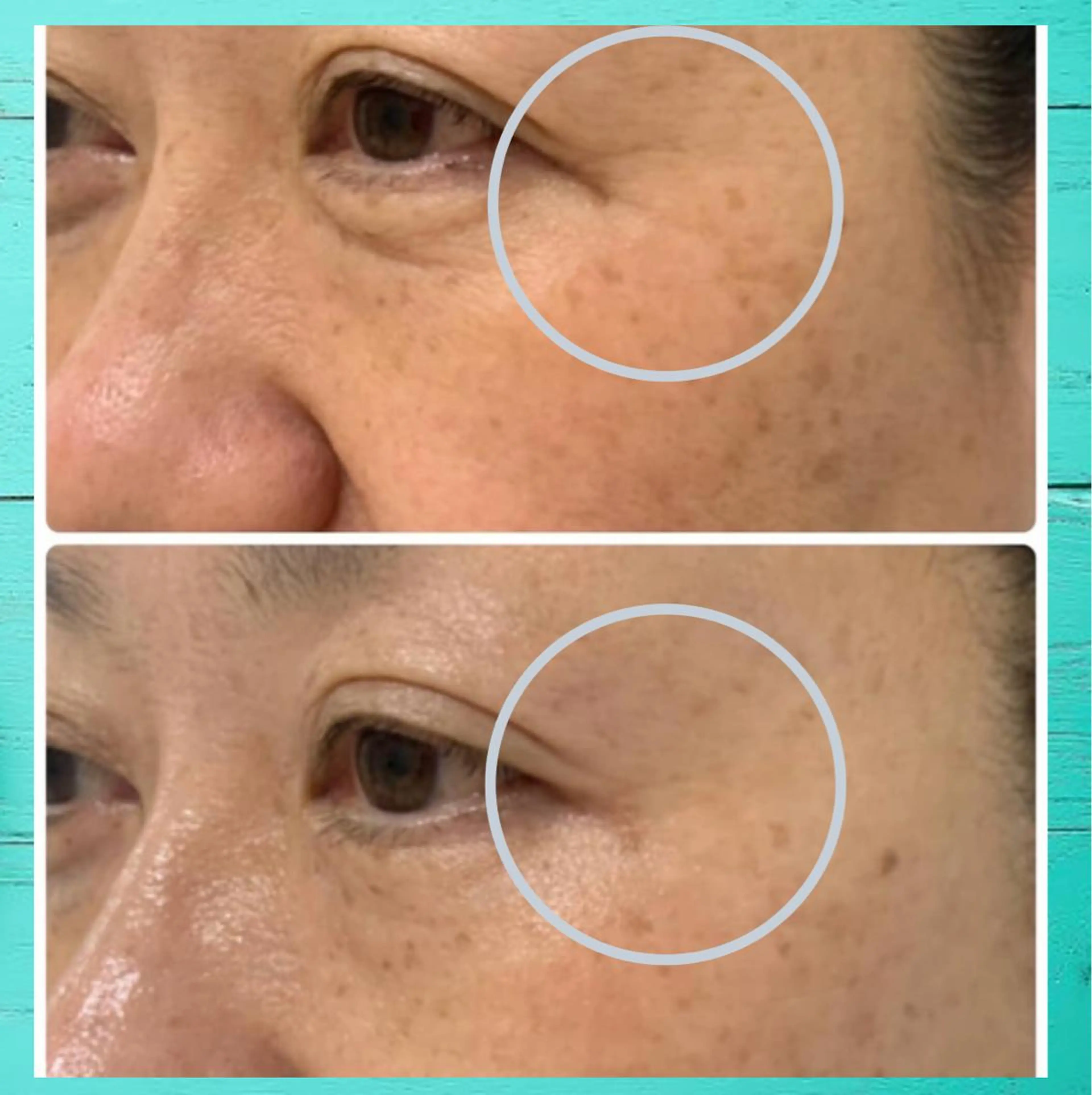 Lumiere despoir所属・Lumiere despoirのエステ・リラクイメージ