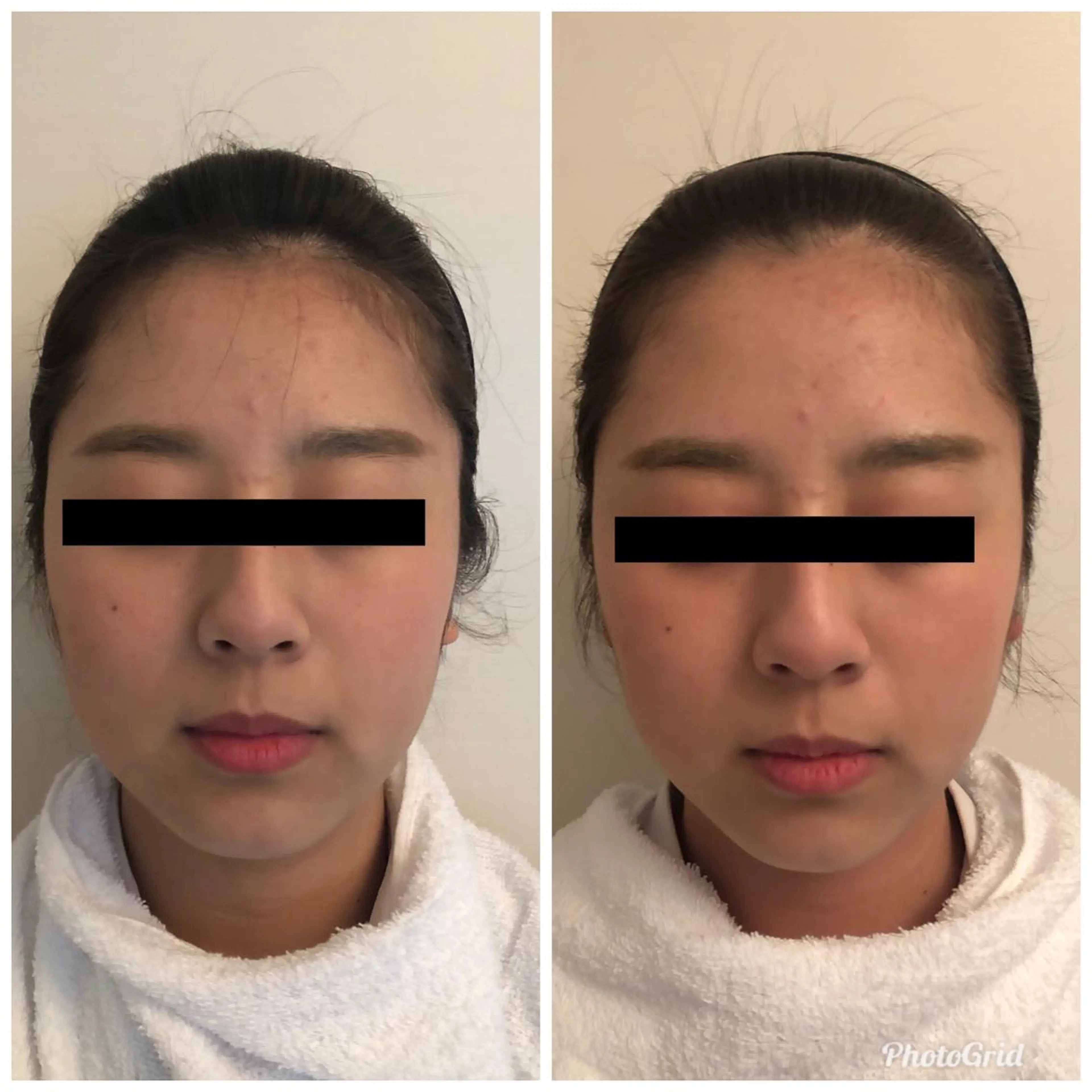 おうちサロン B-ROOMのエステ・リラクイメージ