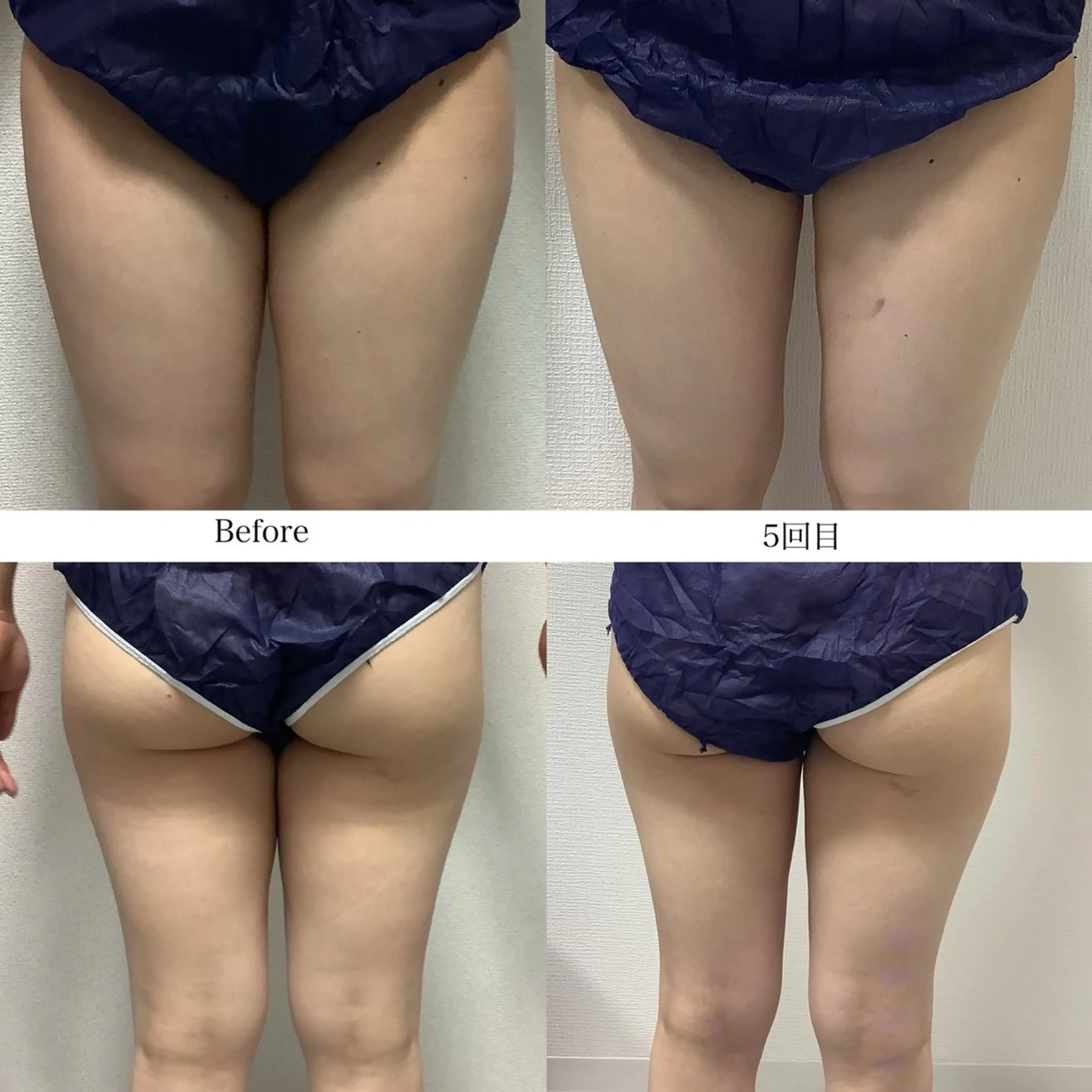 冷却専門店 SLARIのエステ・リラクイメージ