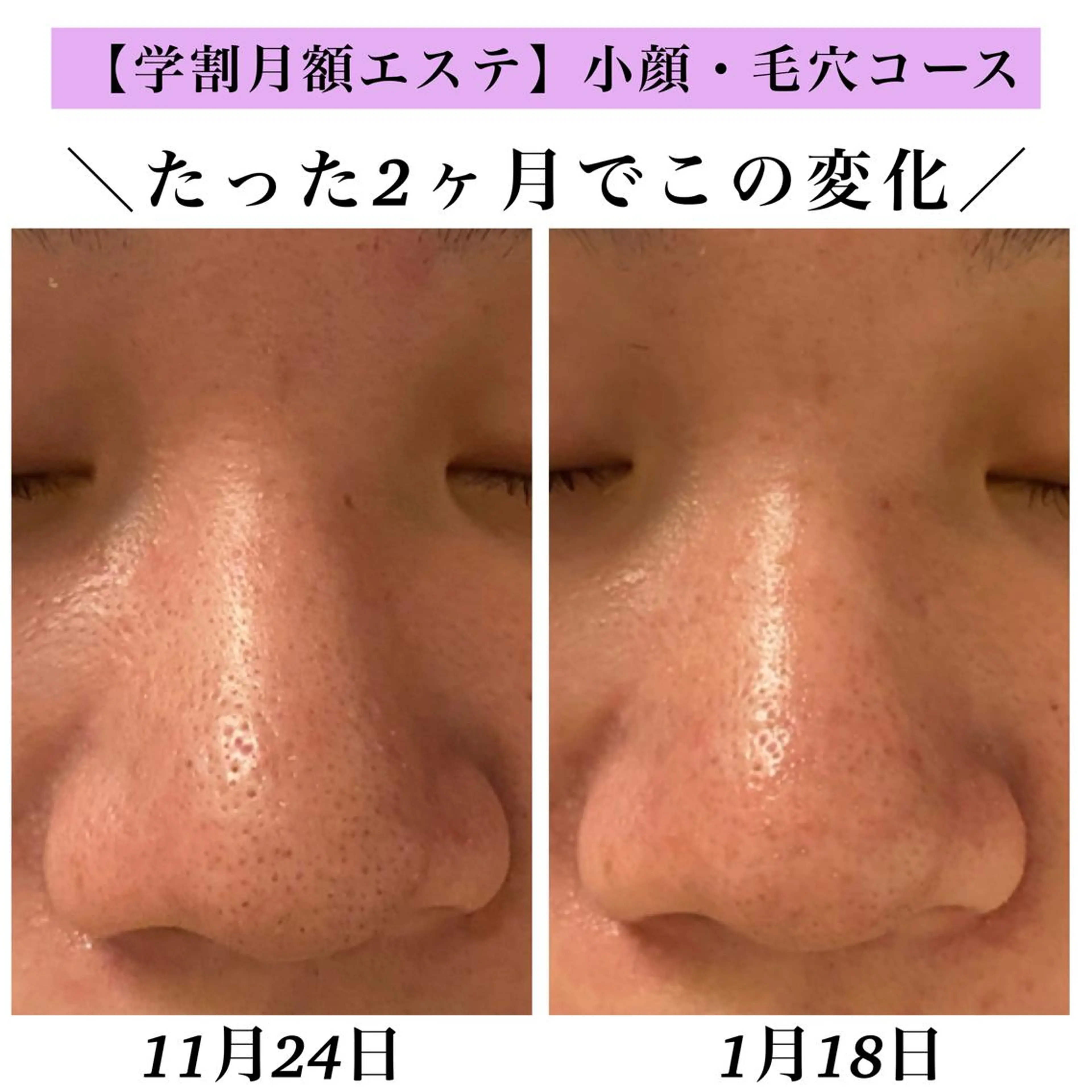 Bellesthe (ベルエステ)のエステ・リラクイメージ