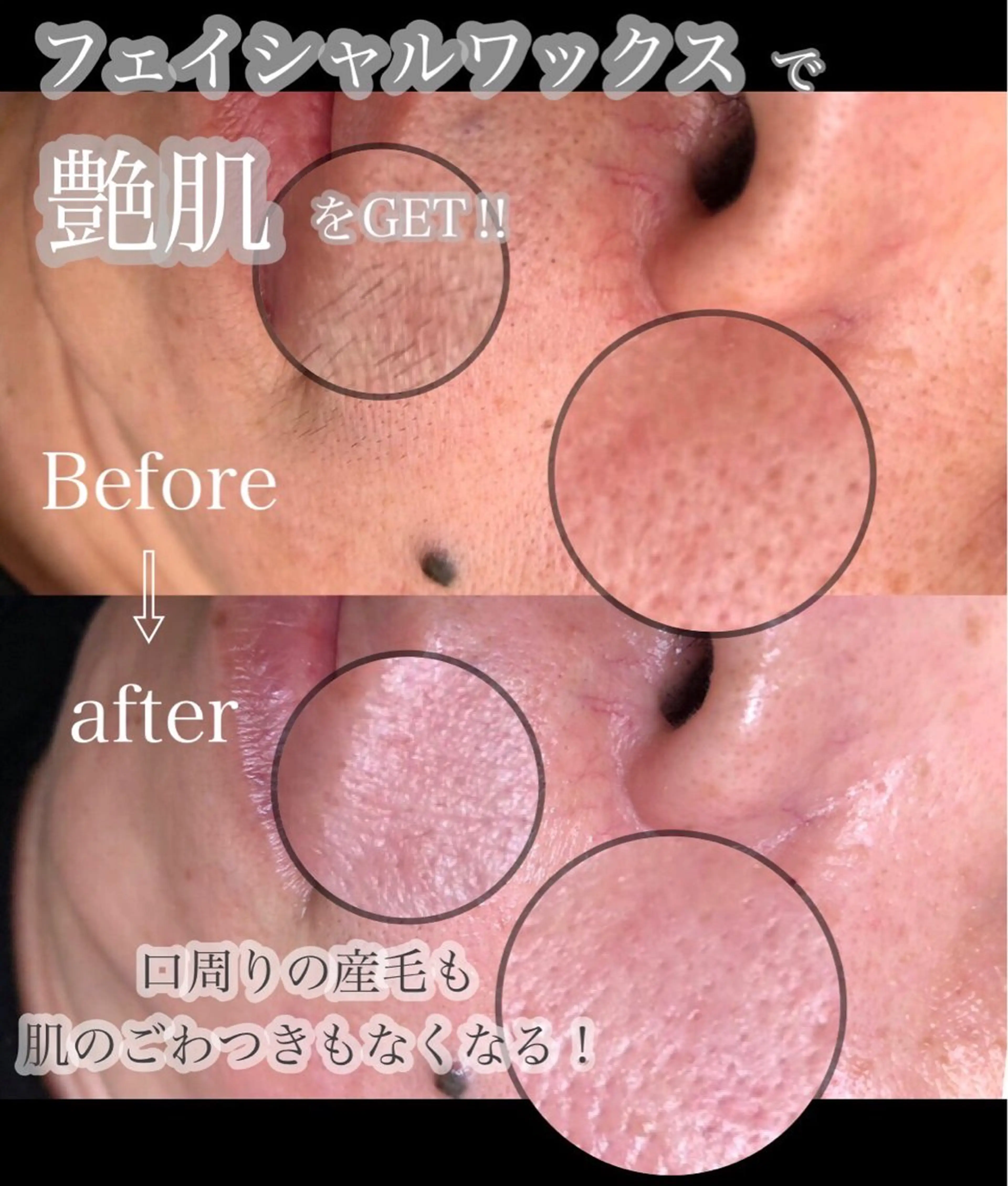 脱毛 eim Ayakaのネイルデザイン