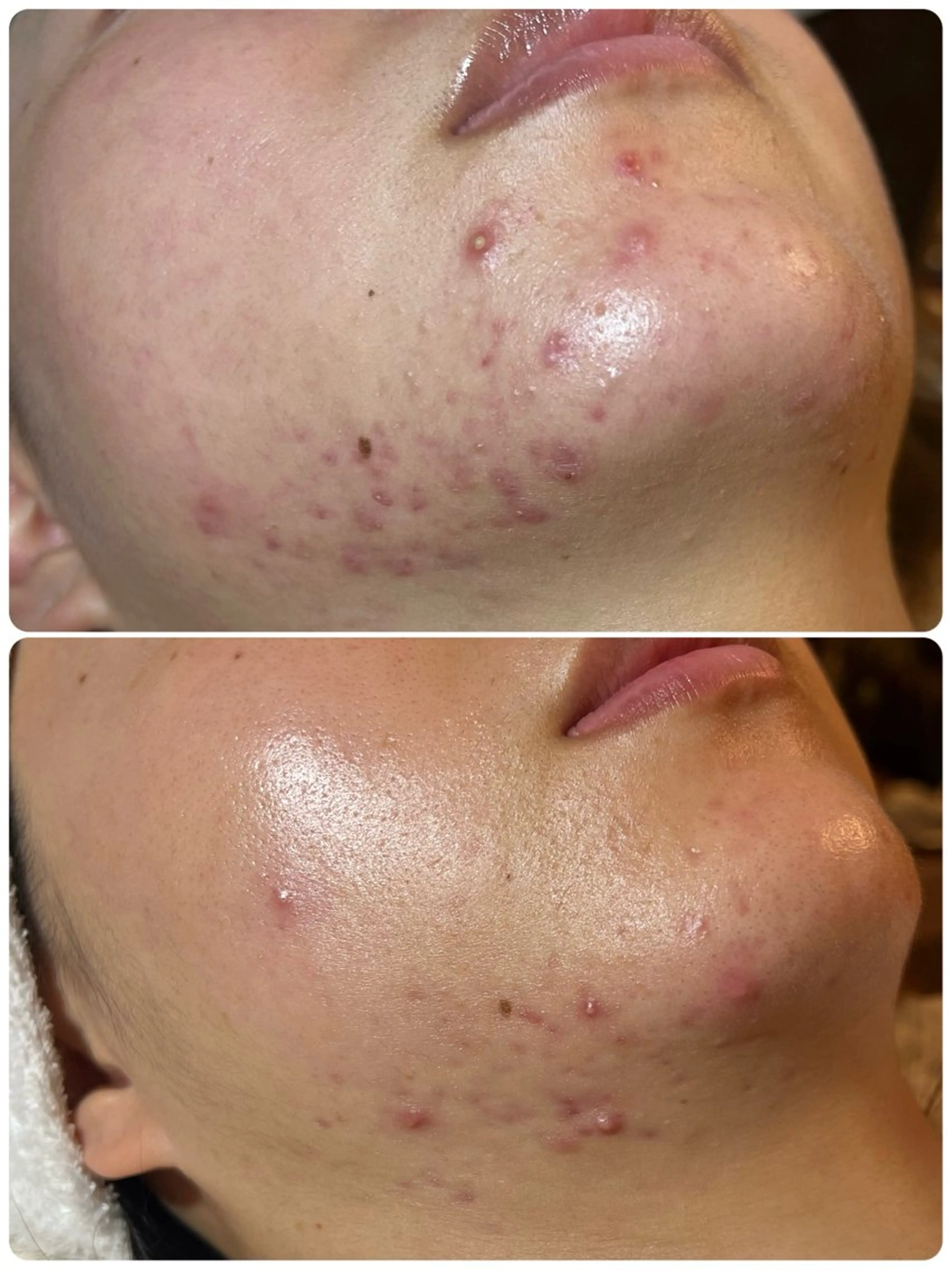 esty hitomiのエステ・リラクイメージ