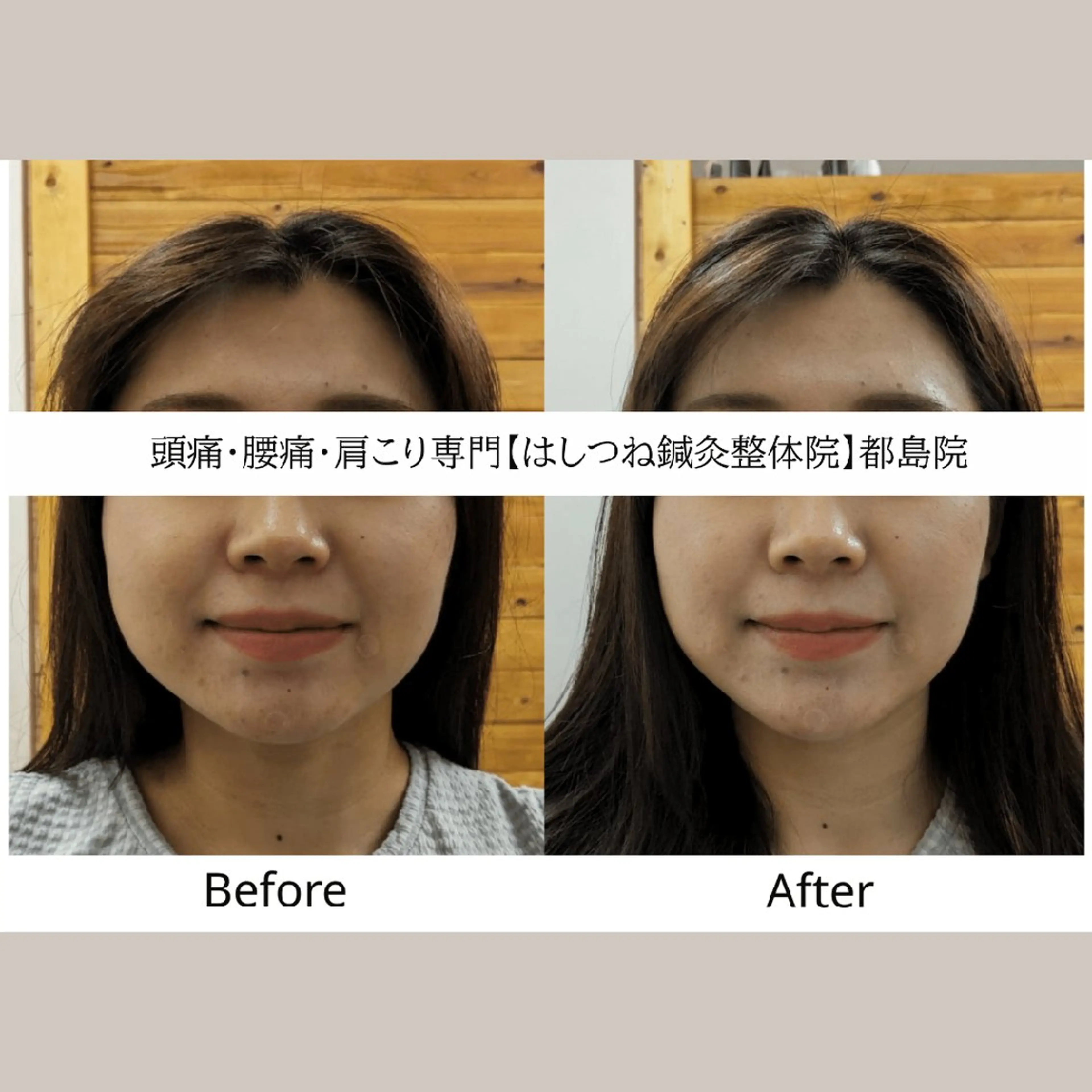 エステ リラク 頭痛・腰痛・美容鍼に 特化してます。　橋岡のエステ・リラクイメージ