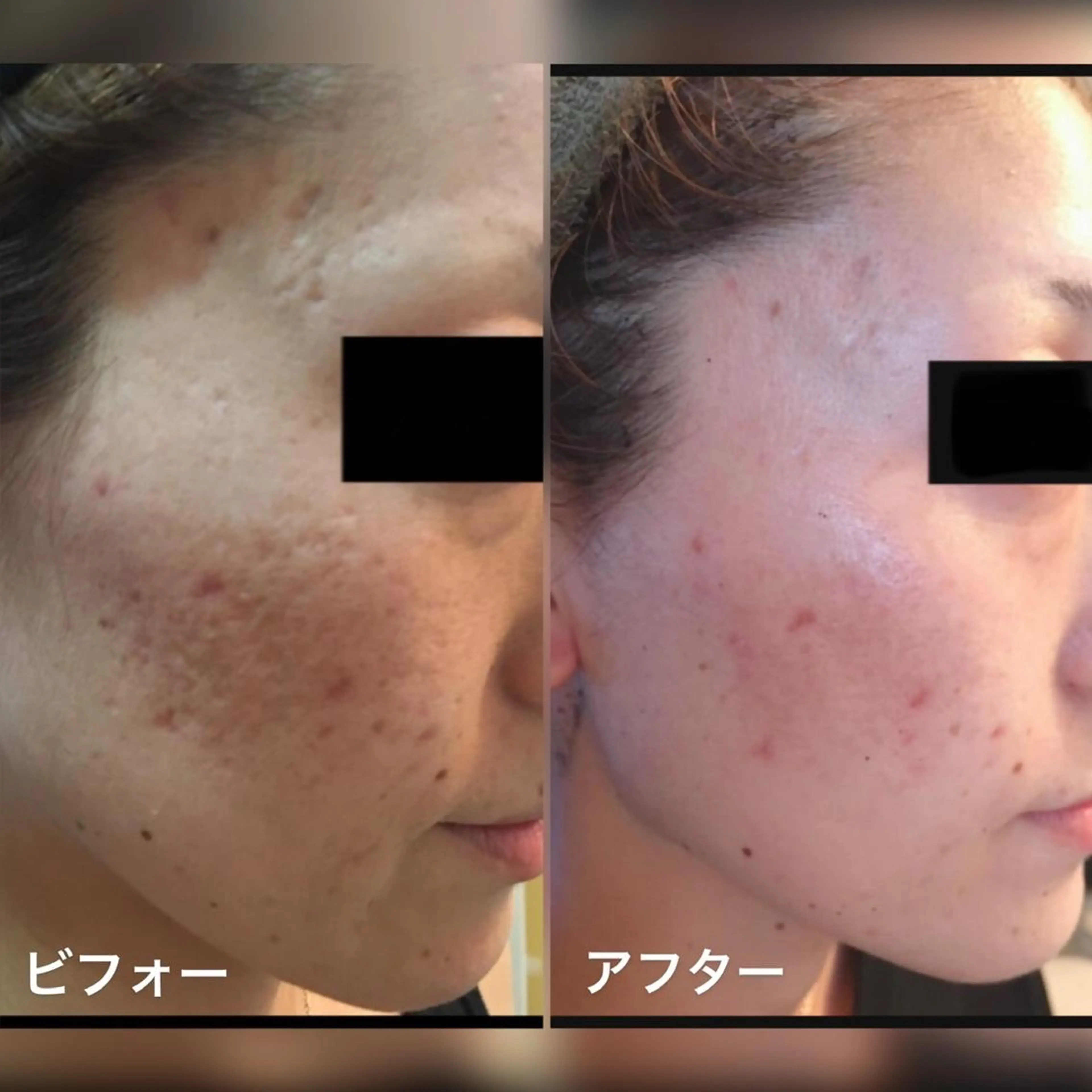 メンズ ネイル マツエク・マツパ アイブロウ KARMA salonのネイルデザイン
