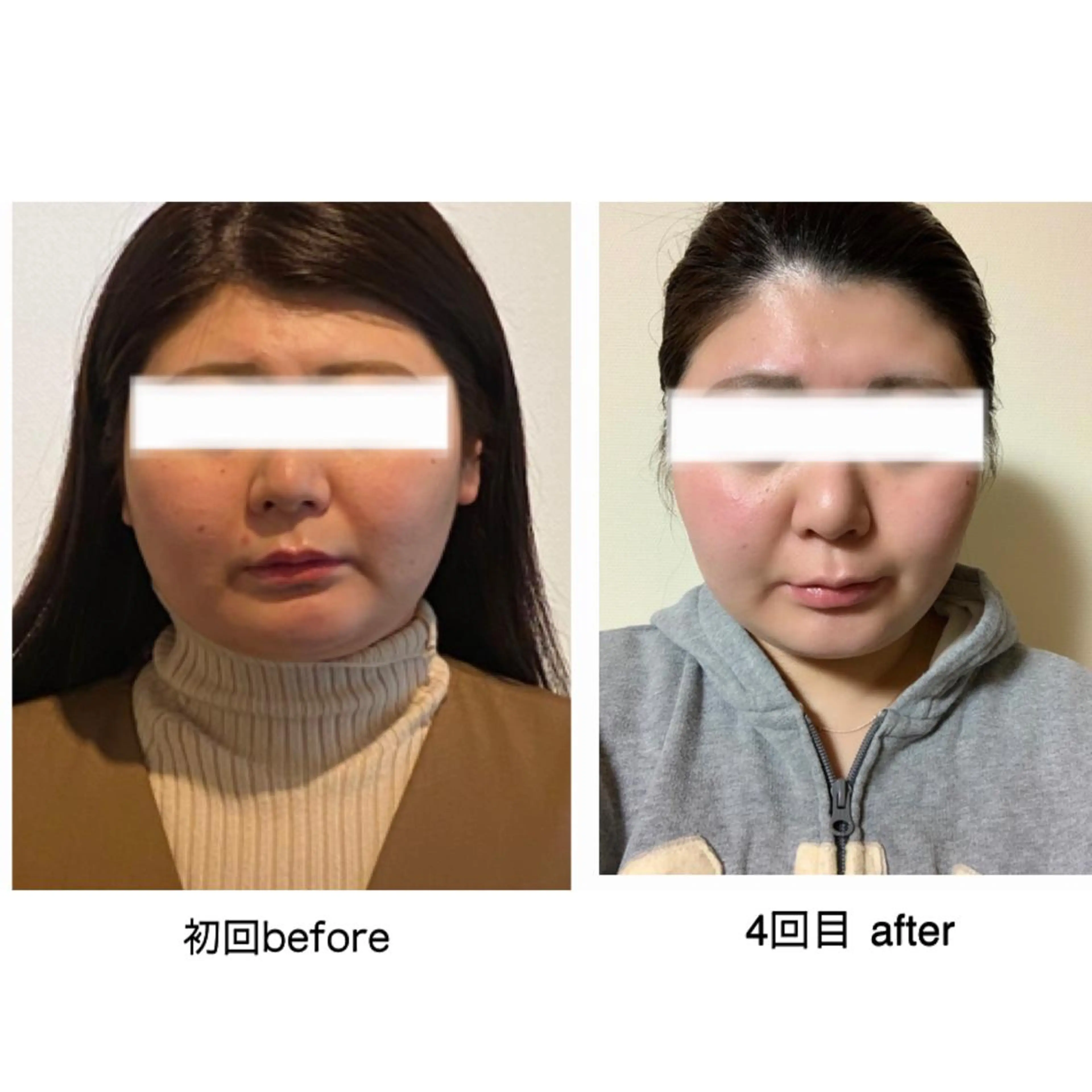セミロング カラー ネイル マツエク・マツパ 小顔カット 小顔矯正専門サロンジュマリ所属・町田 淳子のエステ・リラクイメージ