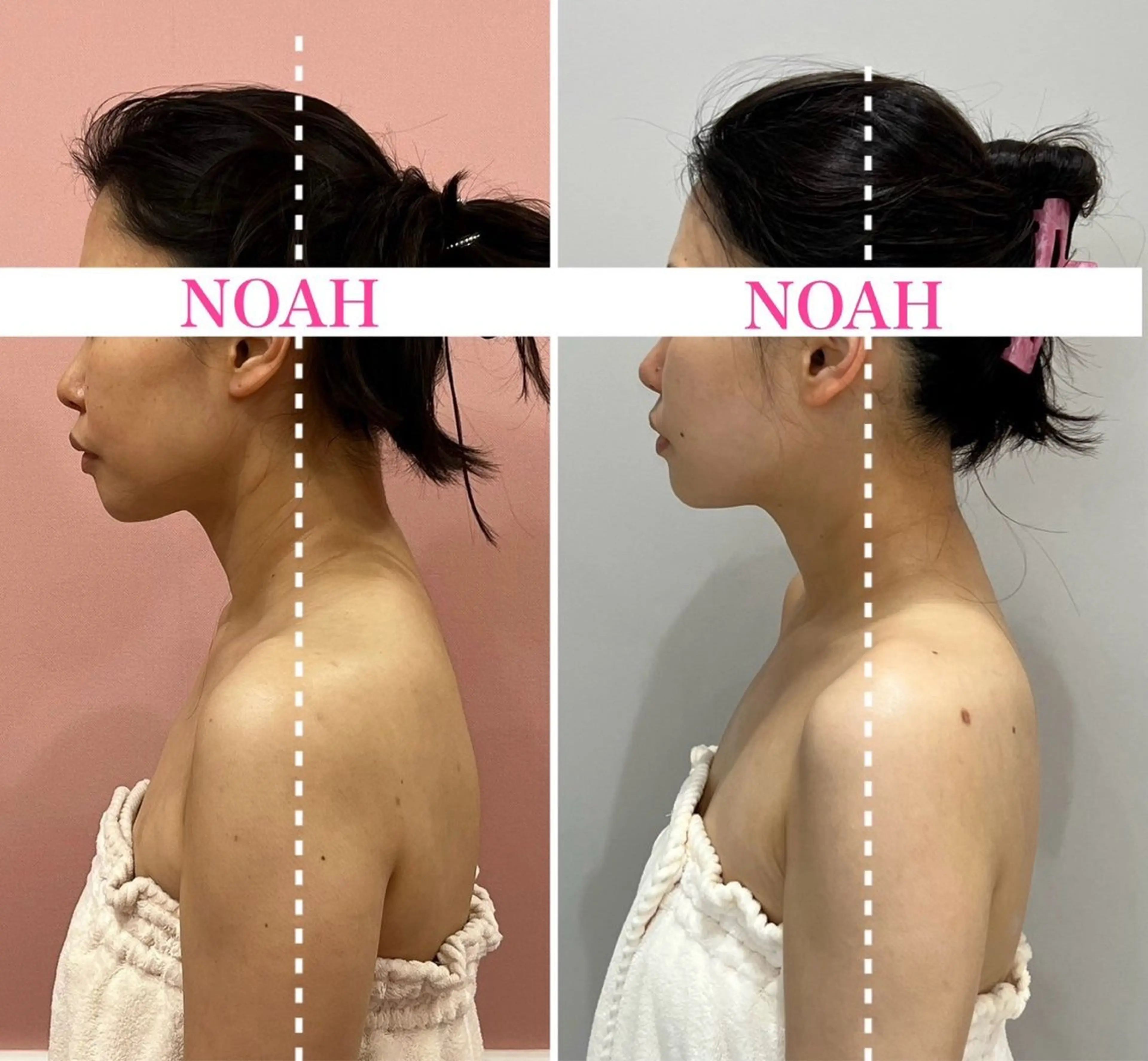 NOAH 小顔毛穴 川越店所属・NOAH ORIEのエステ・リラクイメージ