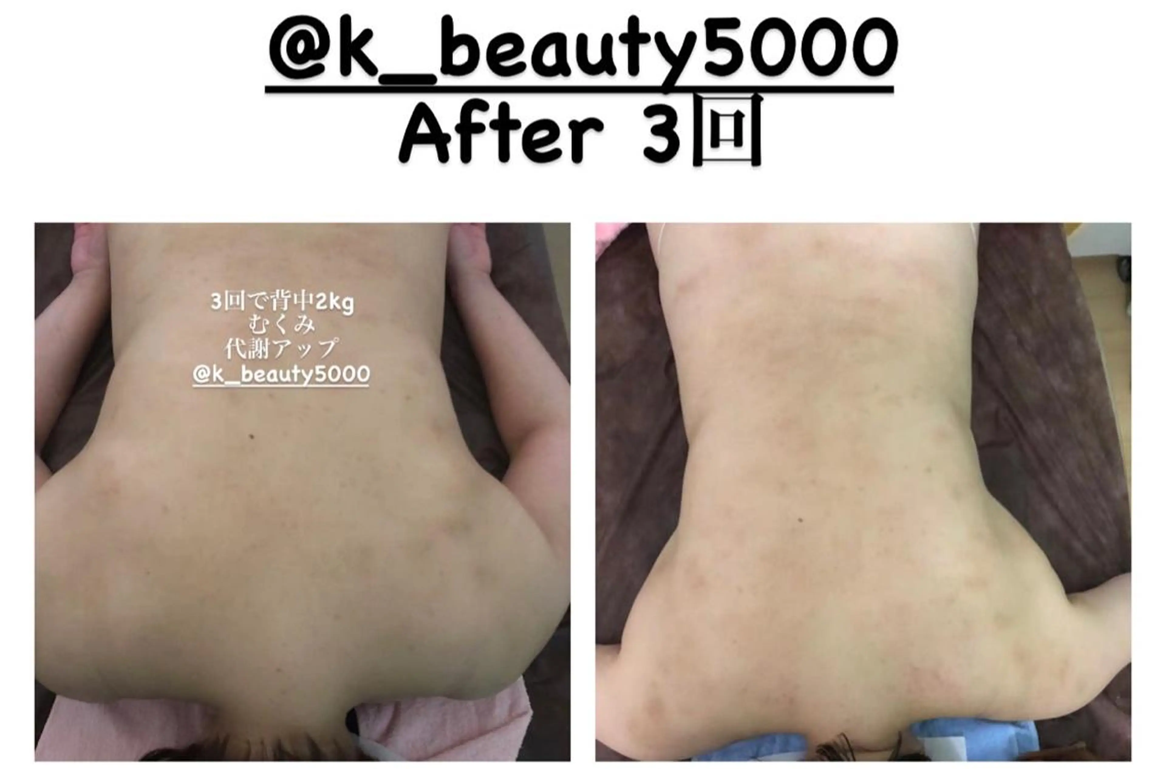 【ハイパーナイフ痩身&小顔コルギ&ハーブピーリング】K-Beauty　東新宿所属・kーbeauty痩身 フェイシャルのエステ・リラクイメージ