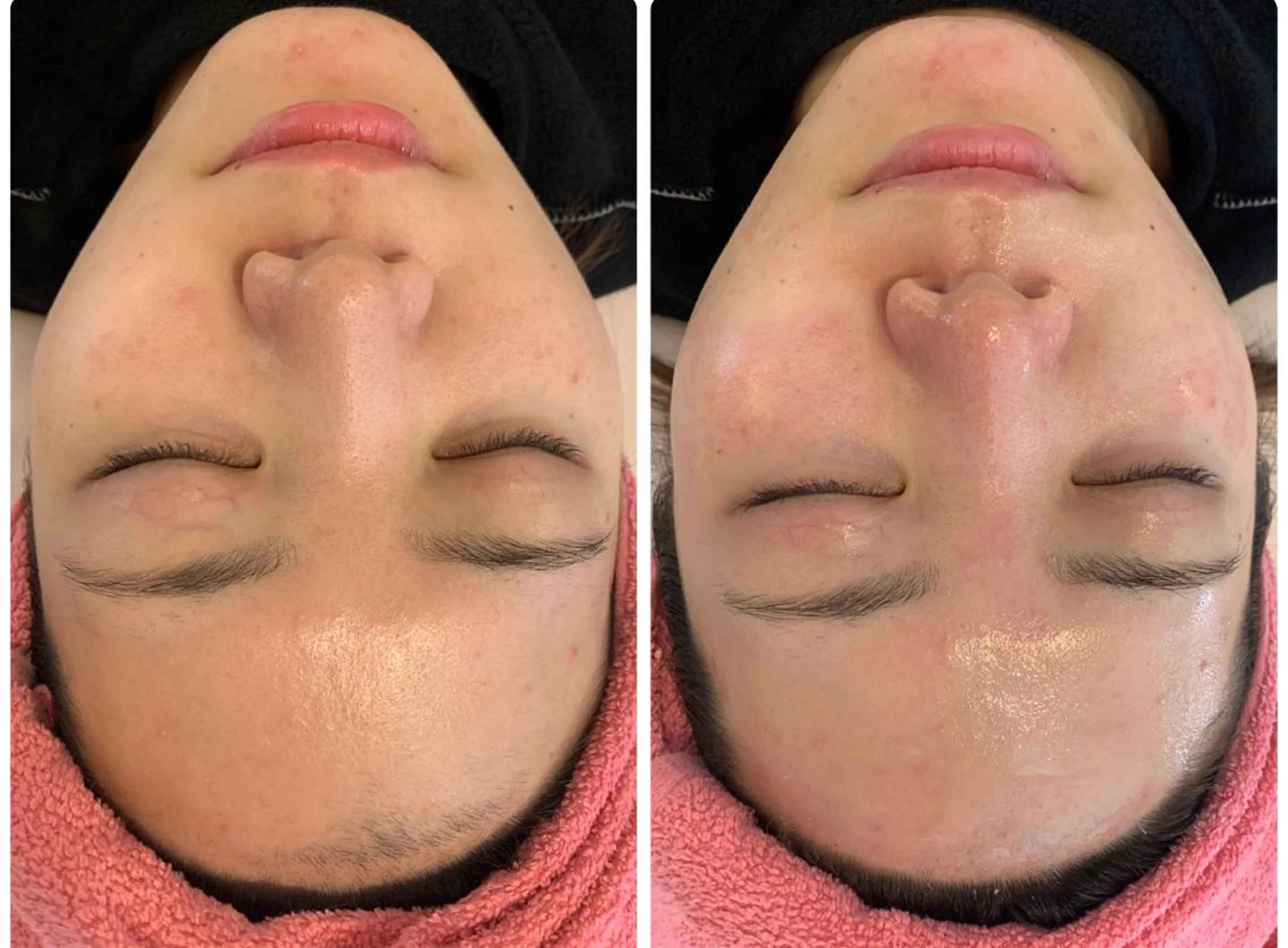 Detox Salon〜Lani Blue〜所属・卒業できるフェイス ワックス専門店のエステ・リラクイメージ