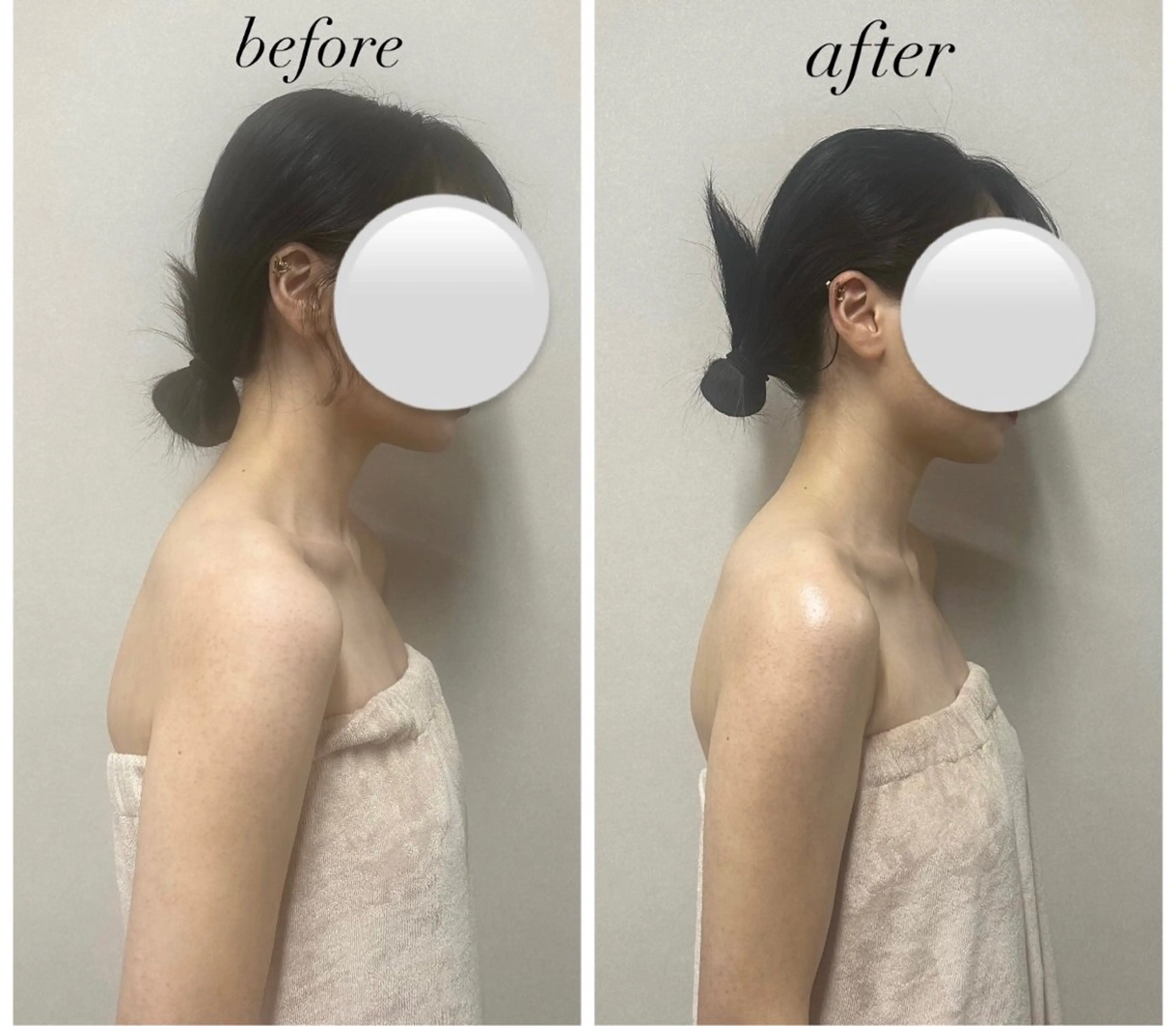 人気No. 1【韓国エステ】コルギ（全顔＋デコルテ）¥11,000→¥3,980の写真