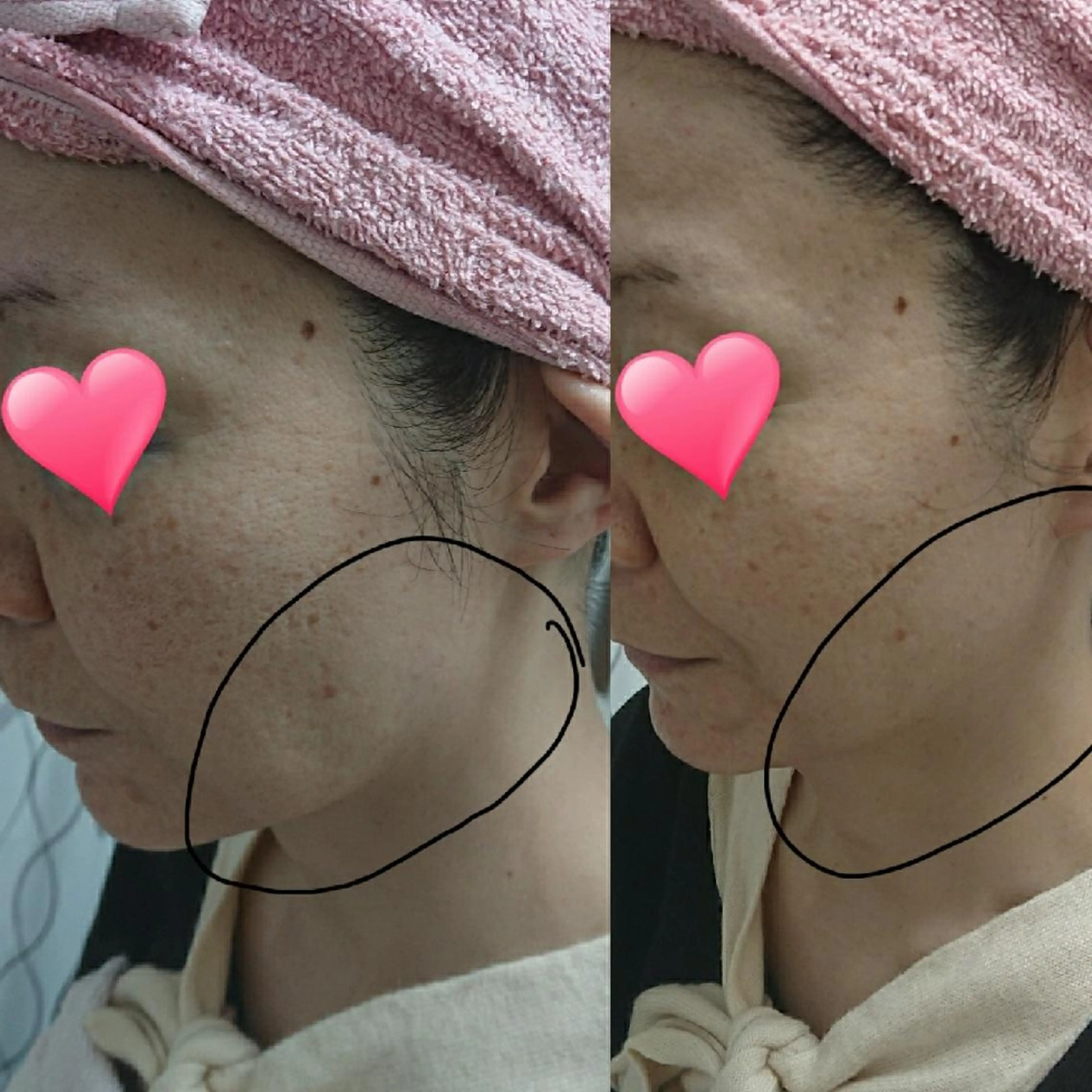 小顔と腸の専門店 ラクーラビューティのエステ・リラクイメージ