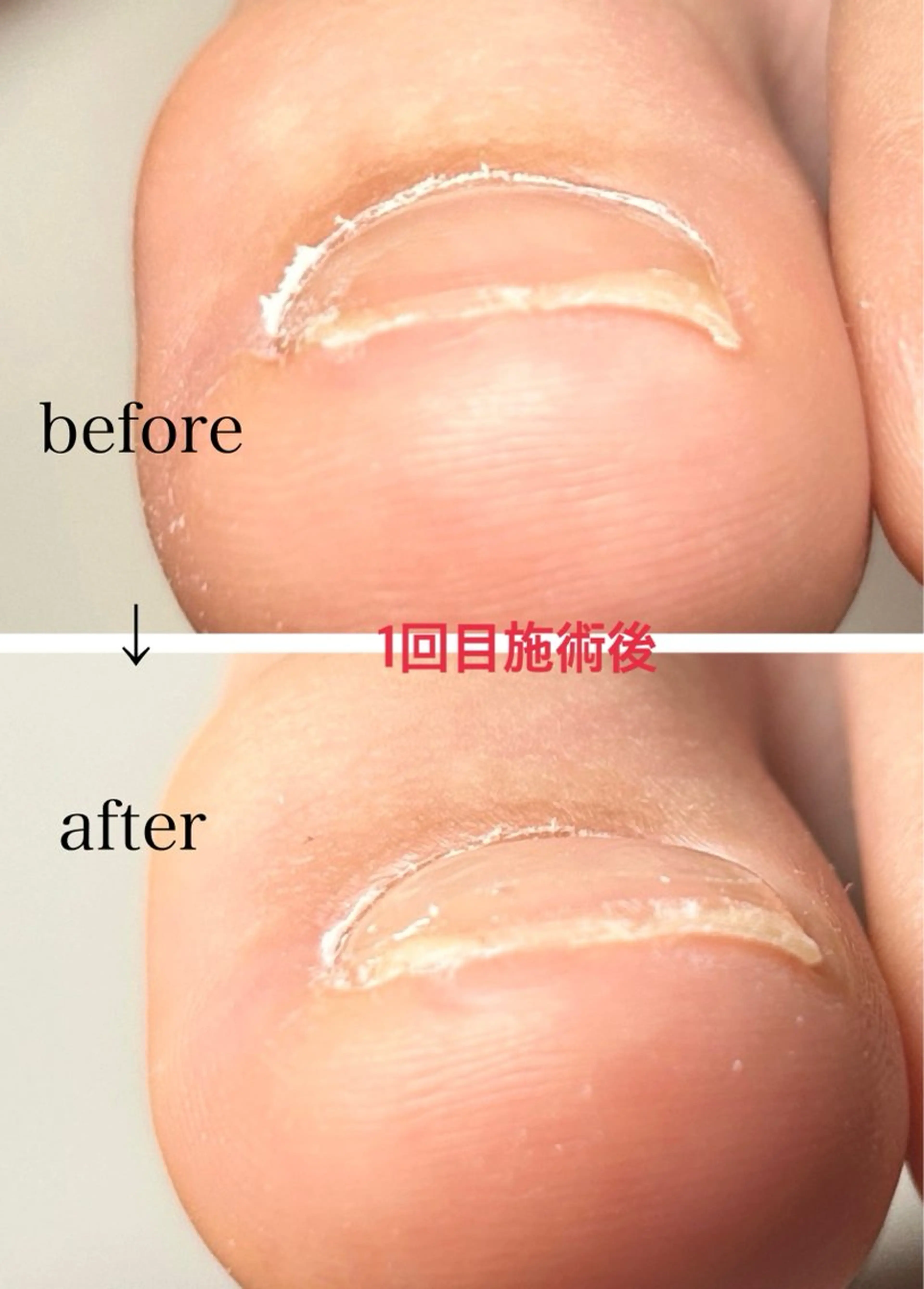 ネイル 春ネイル その他(ネイル) N.style所属・Ｎ. styleのネイルデザイン