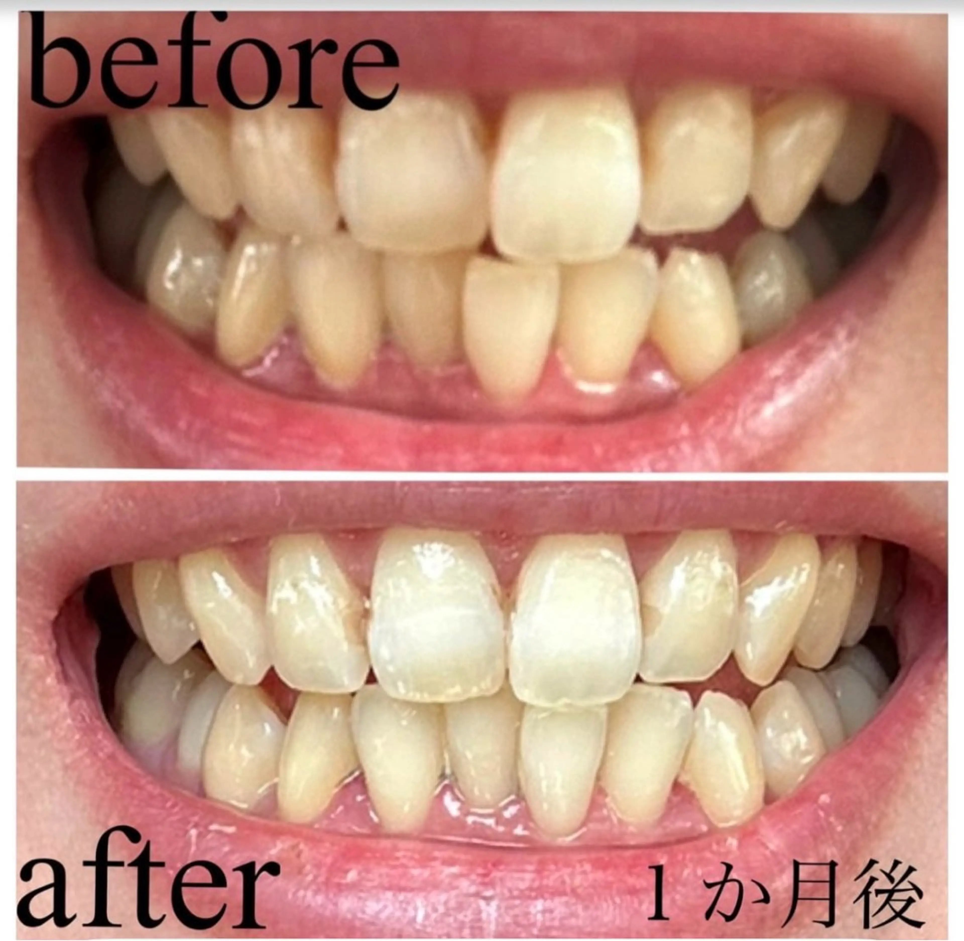 セルフホワイトニング エクシア明石店のその他イメージ