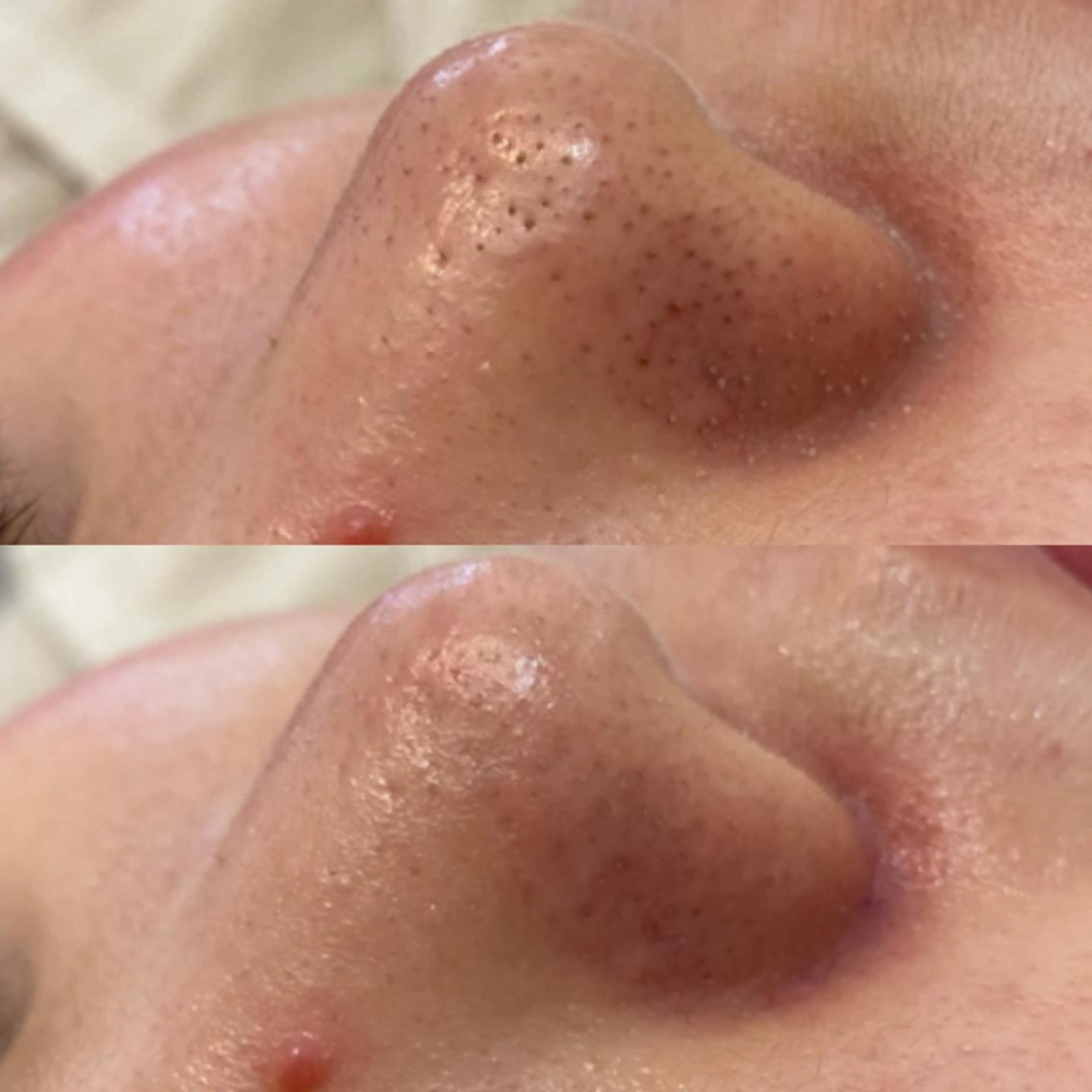 エステ ✨美肌水光✨ アトリエリュバンのエステ・リラクイメージ