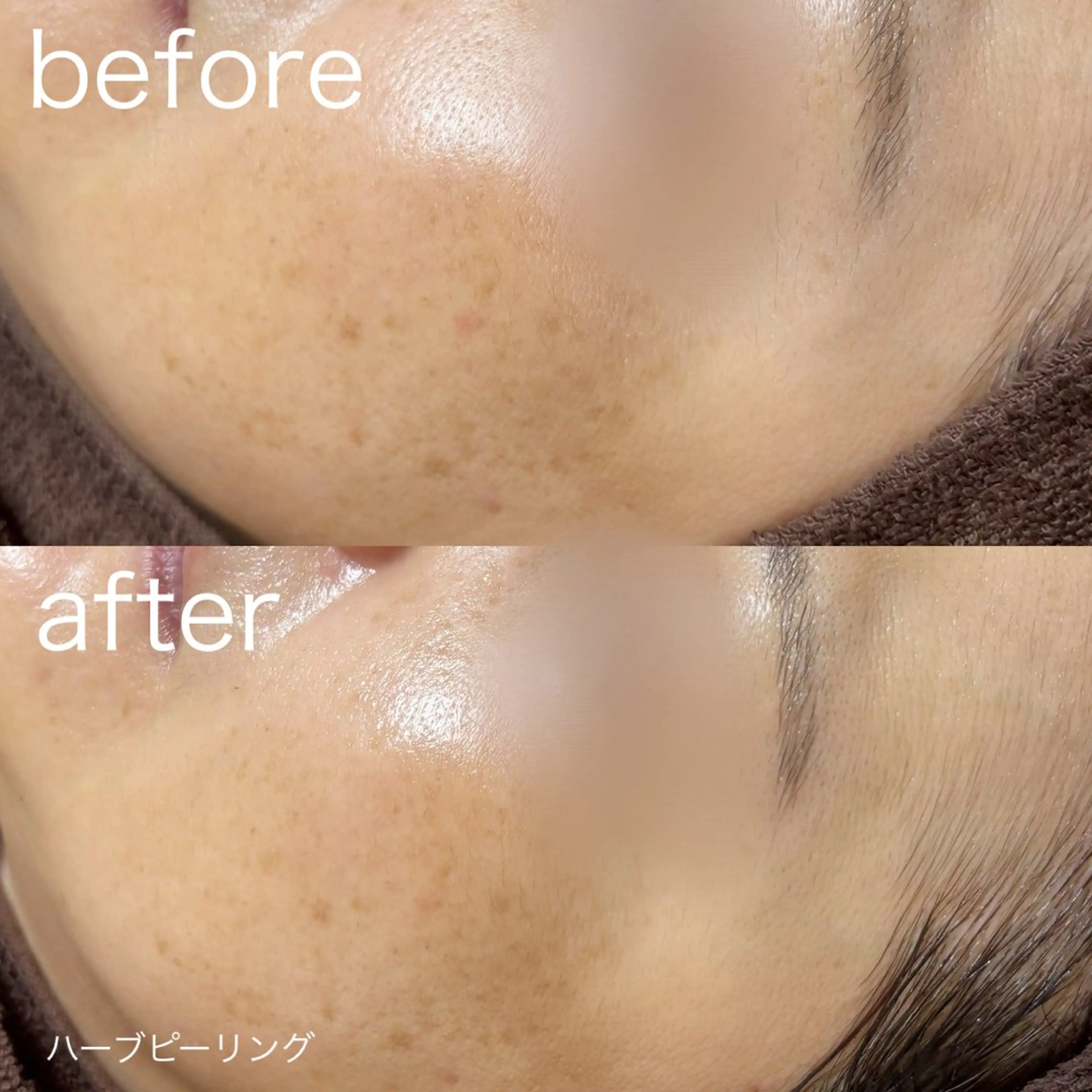 その他 lulularico Yuのエステ・リラクイメージ