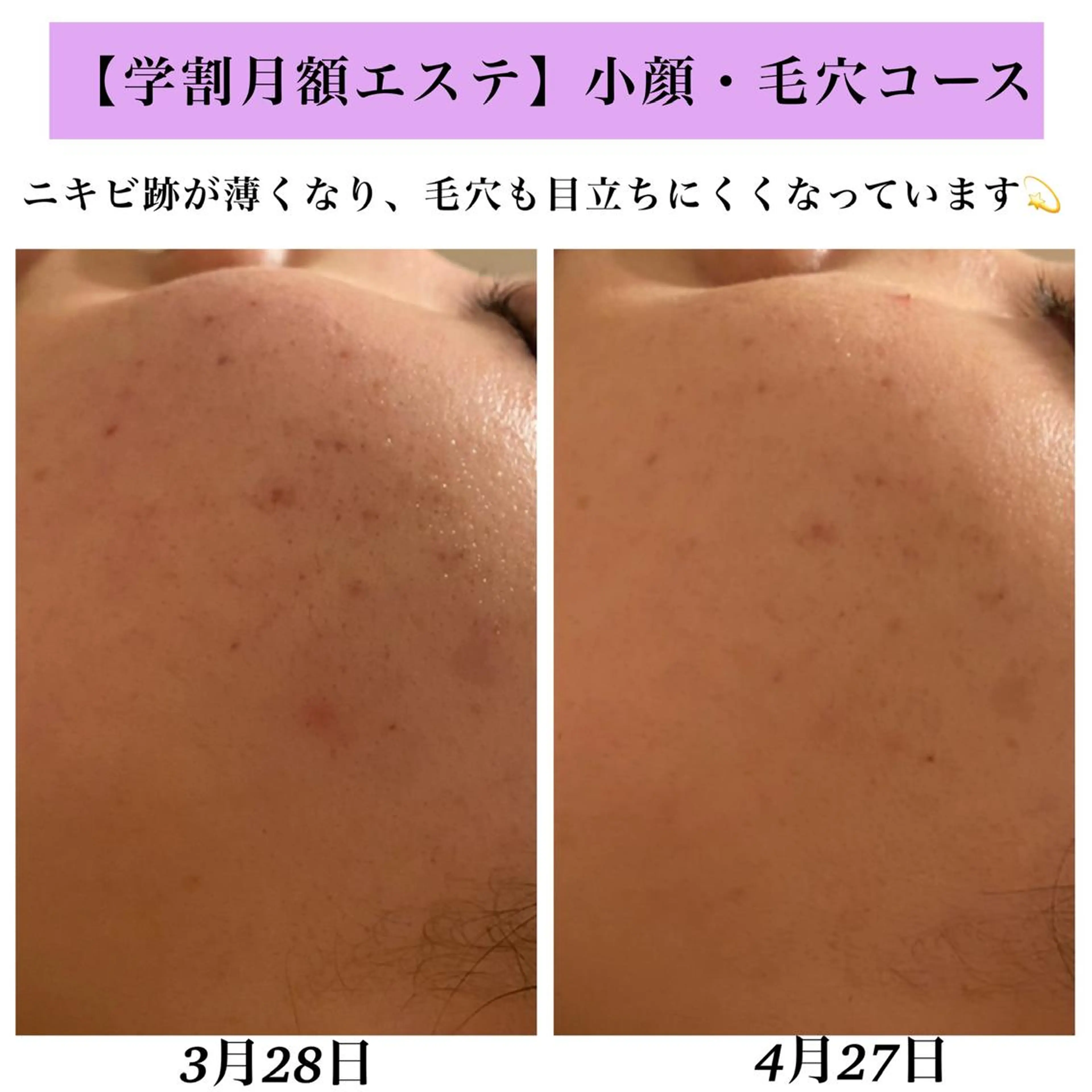 Bellesthe (ベルエステ)のエステ・リラクイメージ