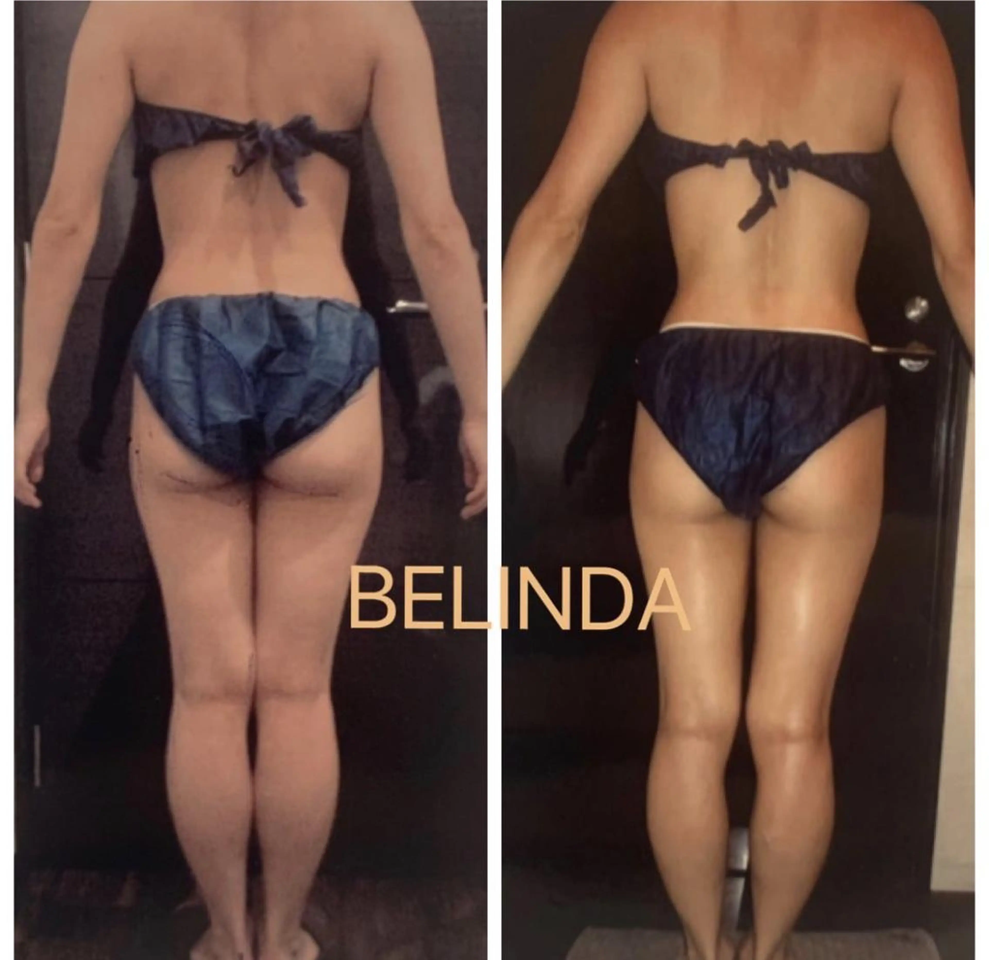 エステ BELINDA銀座店 ✨痩身エステサロン✨のエステ・リラクイメージ