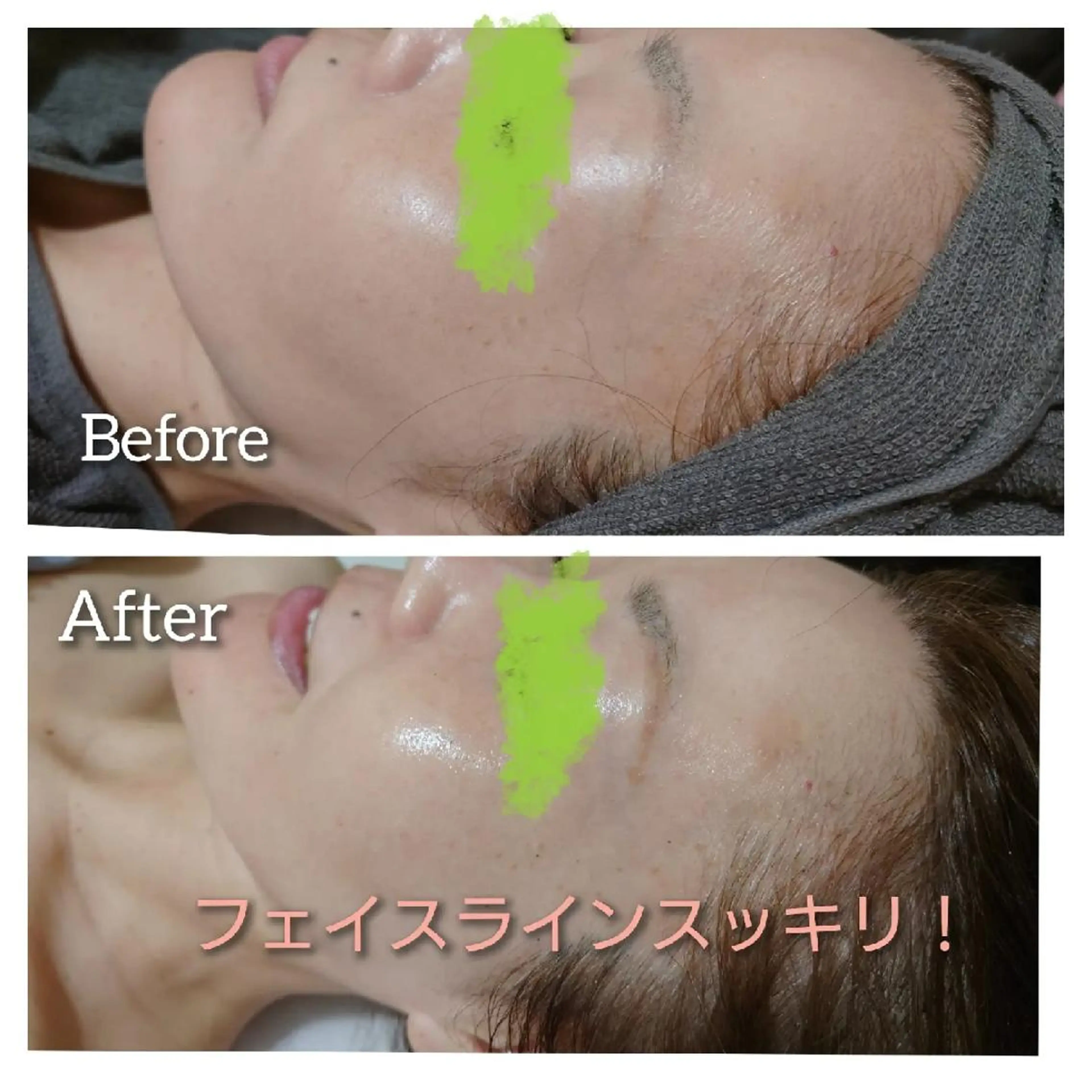 エステ Beauty Salon Luana所属・Luanaまつパ脱毛 ハーブピーリング眉毛のマツエク・マツパデザイン