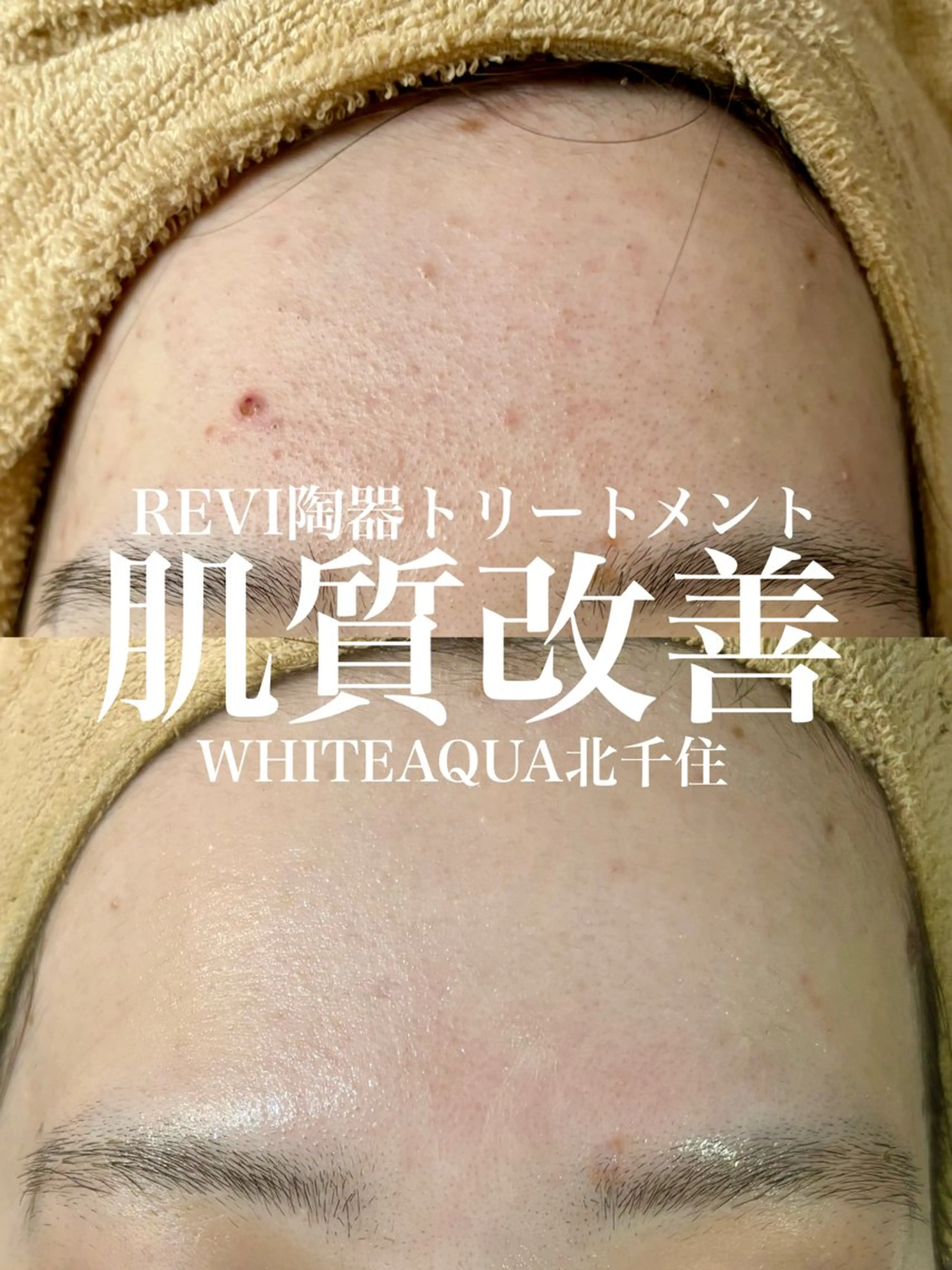 エステ WHITE AQUA 北千住店のエステ・リラクイメージ