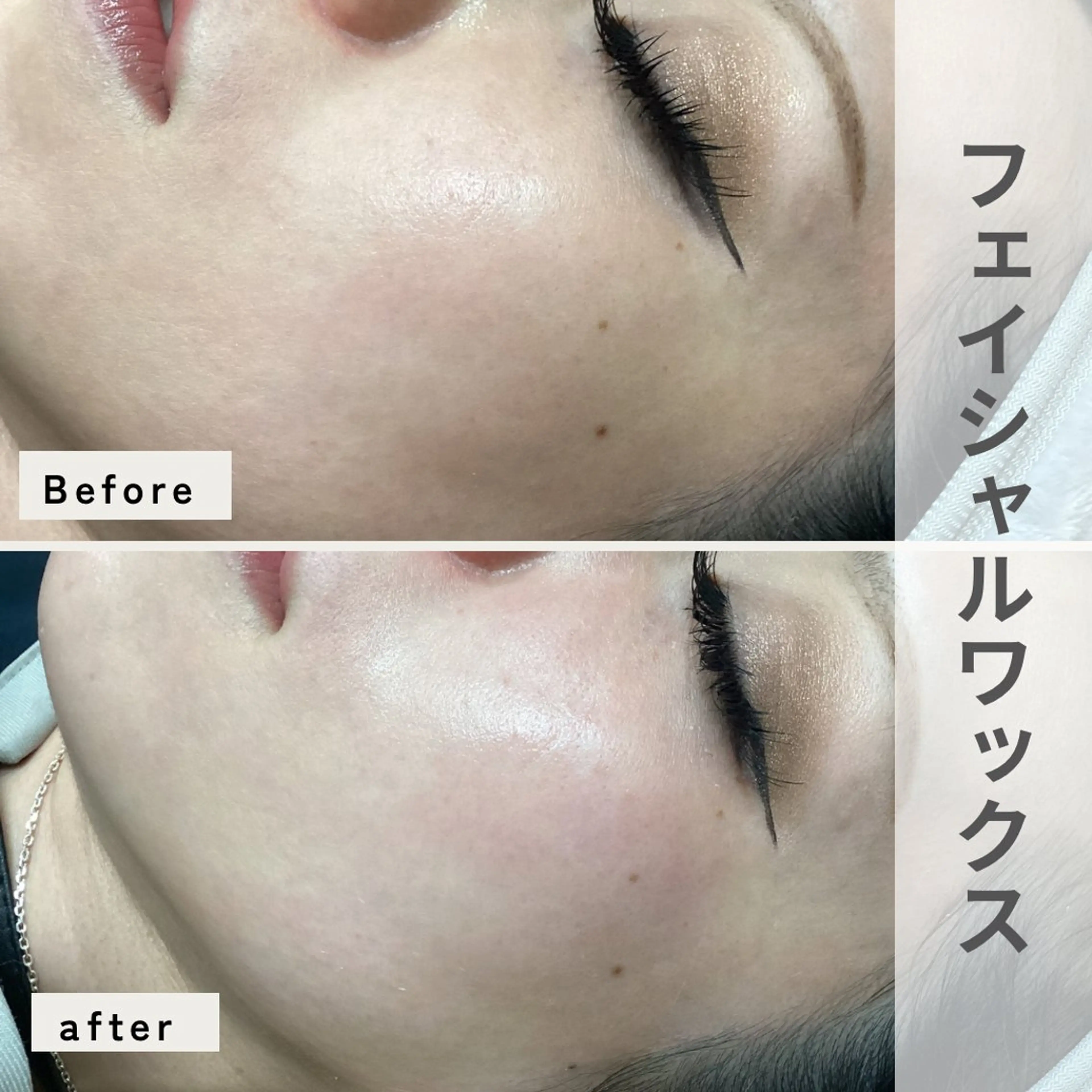 11/21(金)限定！【お肌ツルツル✨】フェイシャルwax(全顔)保湿パック付き🫧の写真