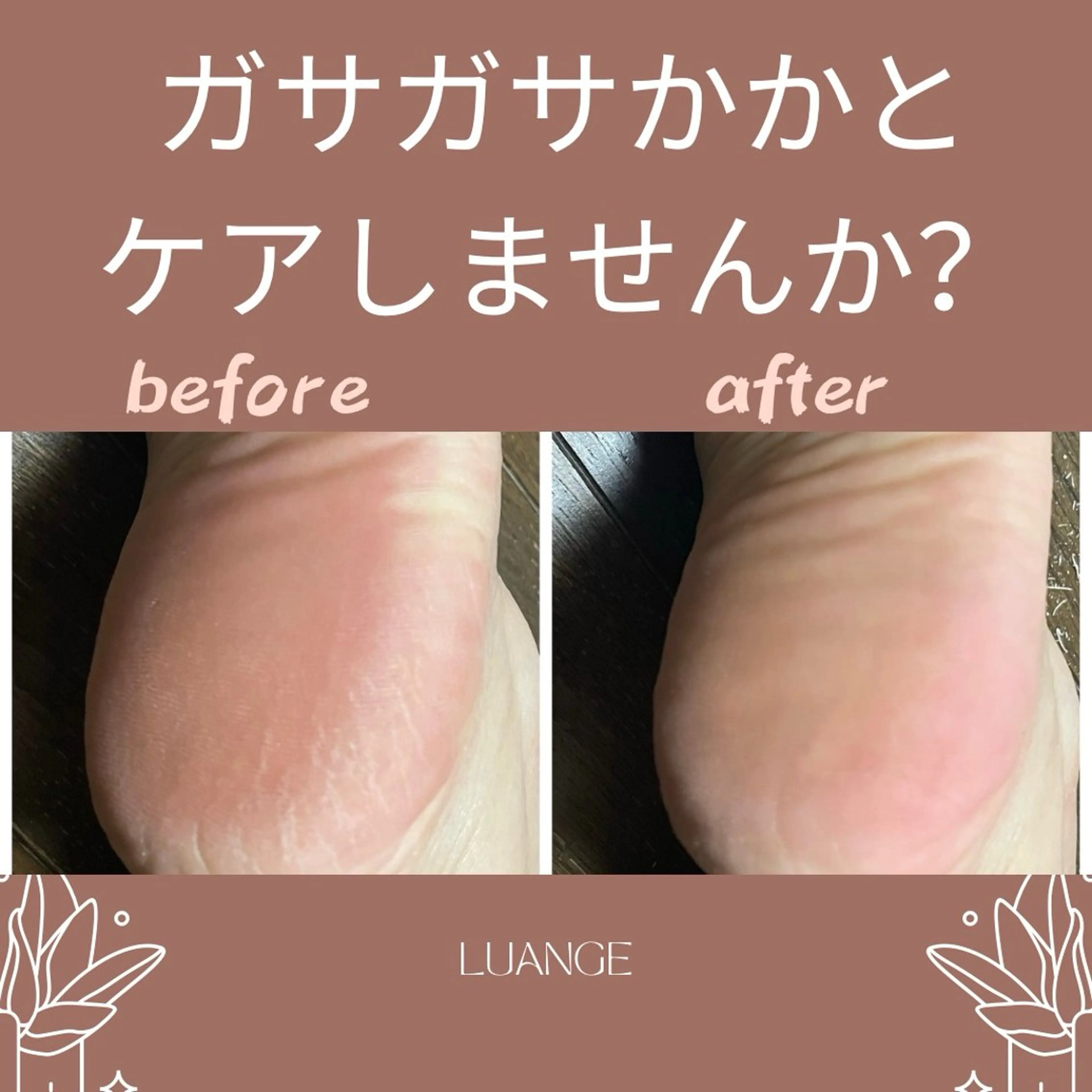 メンズ キッズ 肌質改善・脱毛サロン Luangeのエステ・リラクイメージ