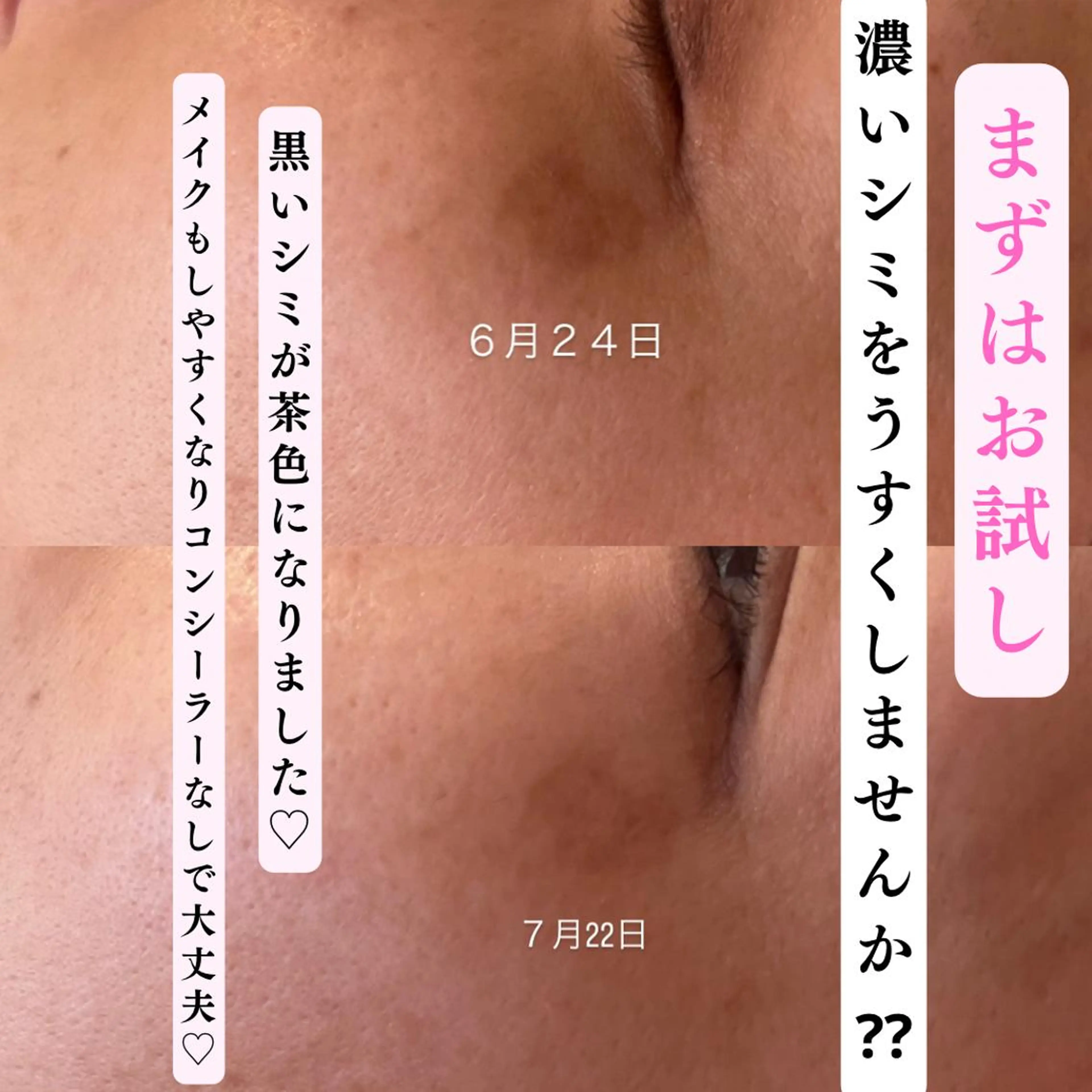 salon＿drop所属・salon dropのエステ・リラクイメージ