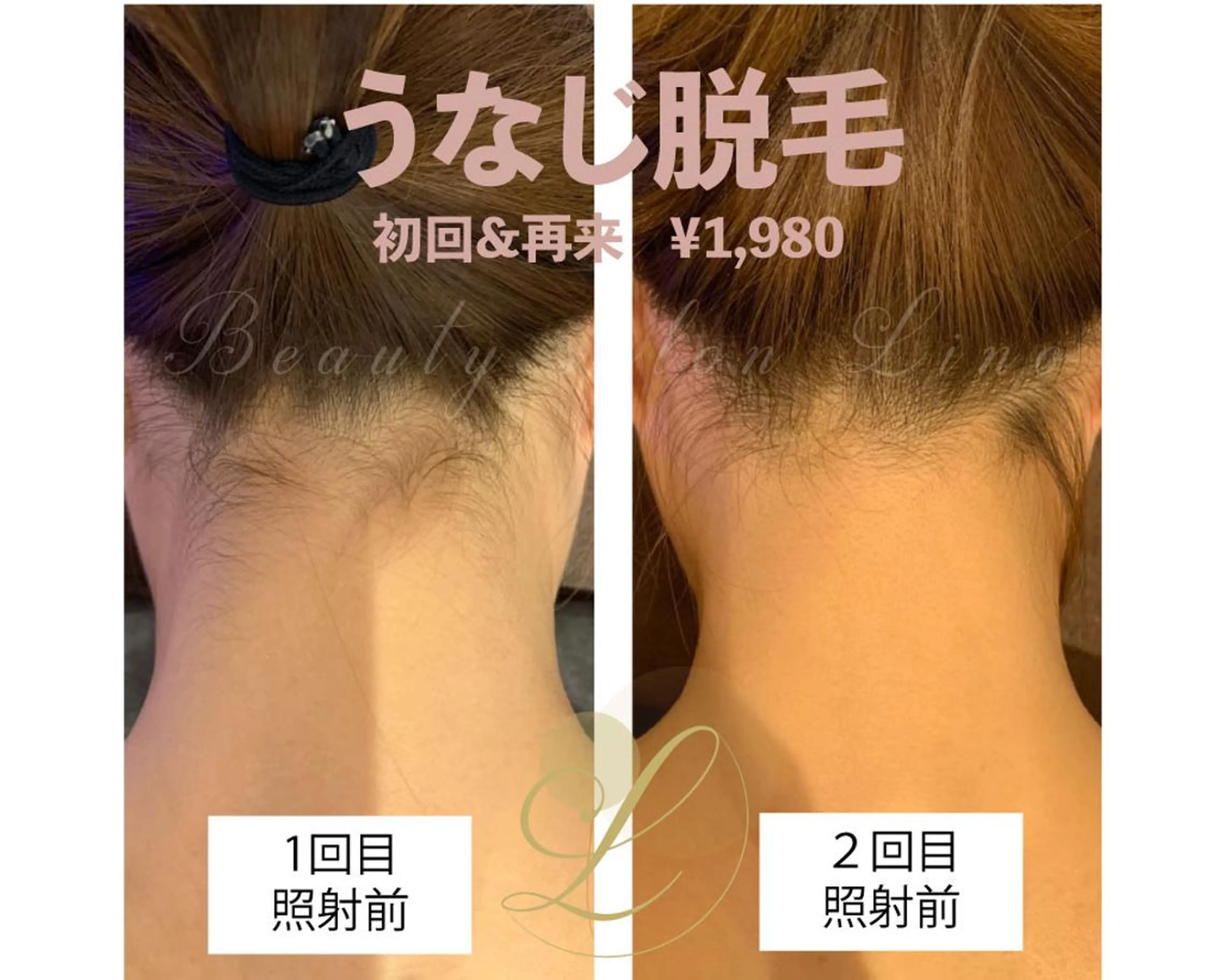 脱毛 Beauty  salon Lino所属・美肌特化の イオン導入脱毛のエステ・リラクイメージ