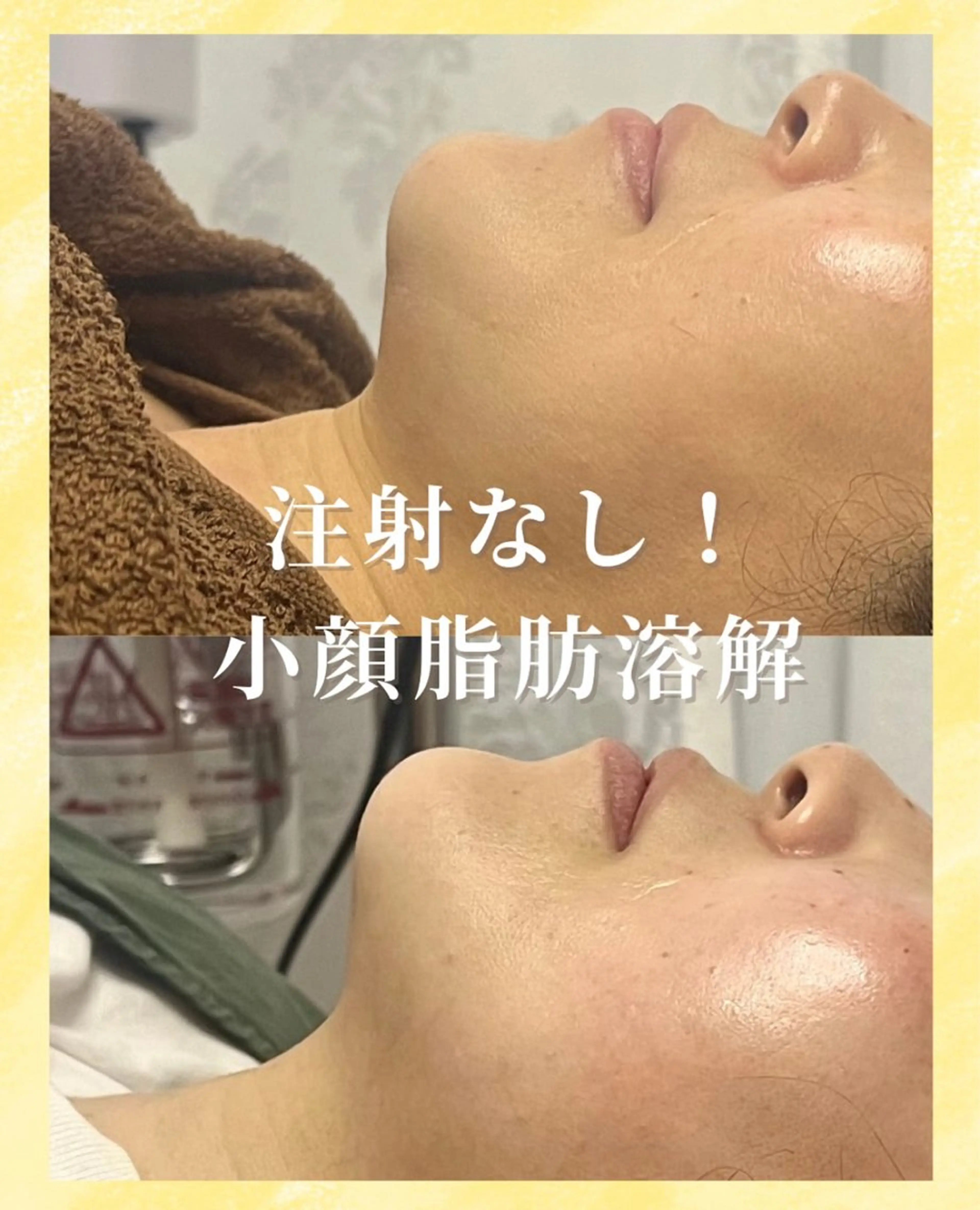 看護師が施術する ナスサロ/Emi🪽のエステ・リラクイメージ