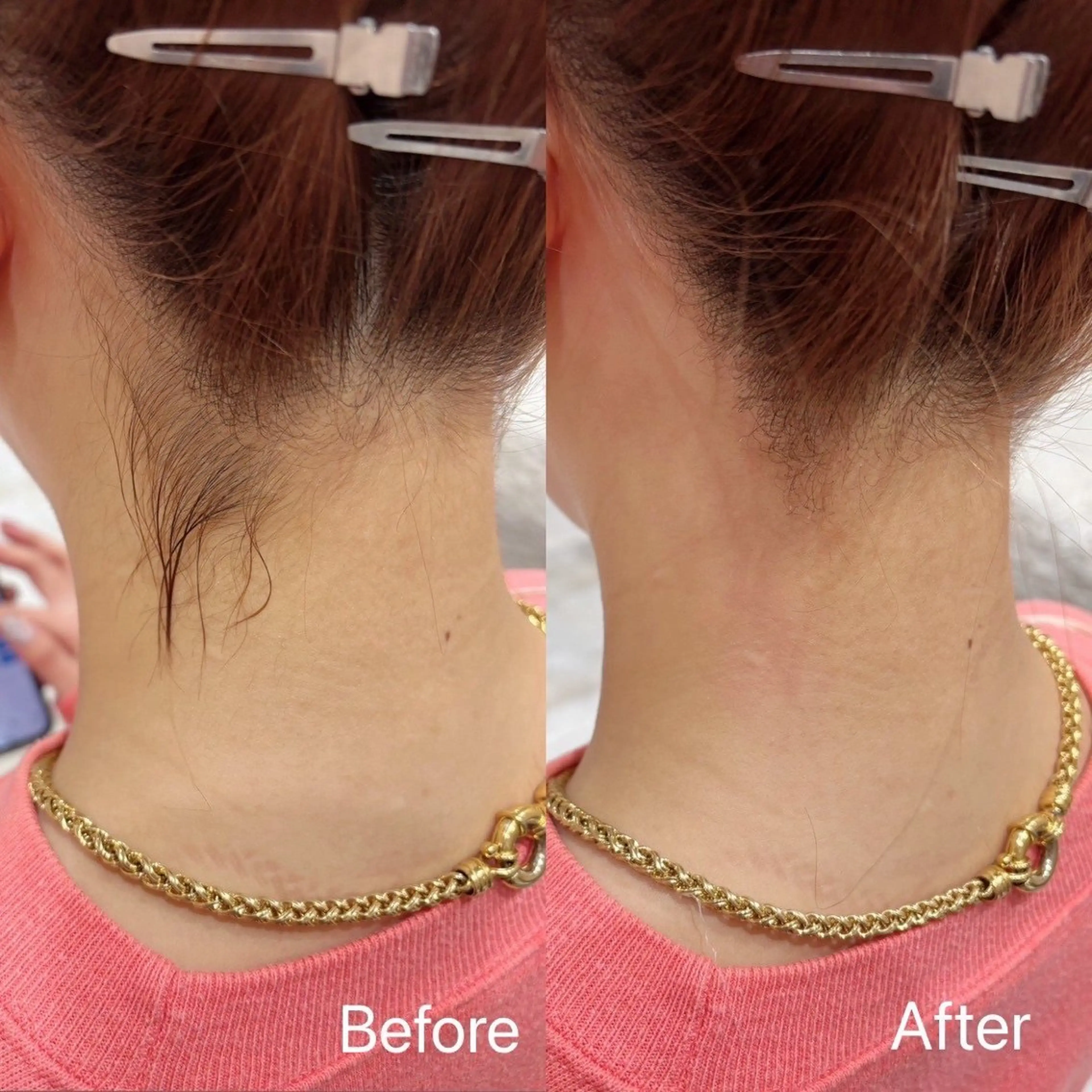 うなじワックスの写真