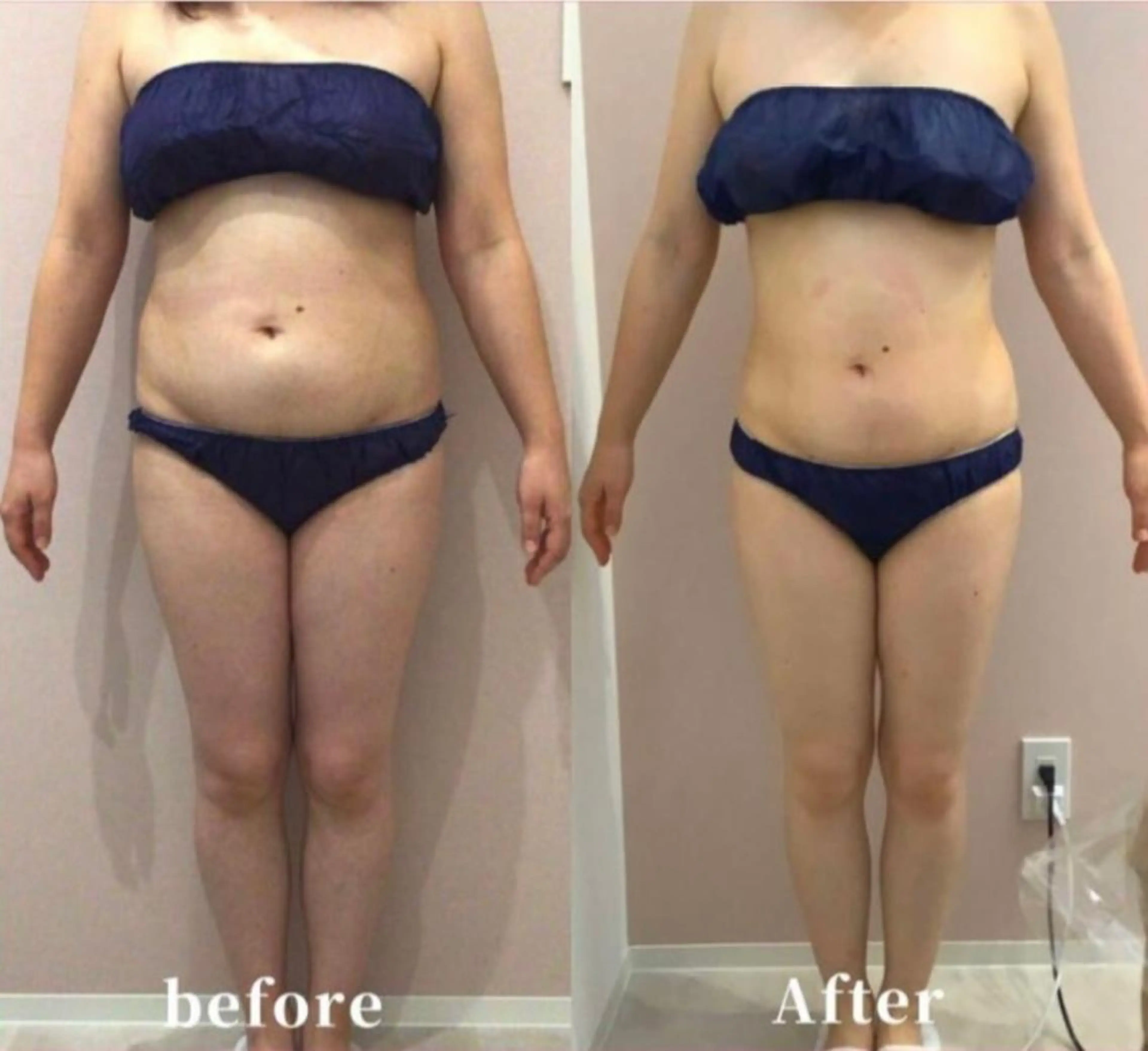 エステ beautysalon SAKUセンター南所属・ビューティーサロン SAKU センター南のエステ・リラクイメージ