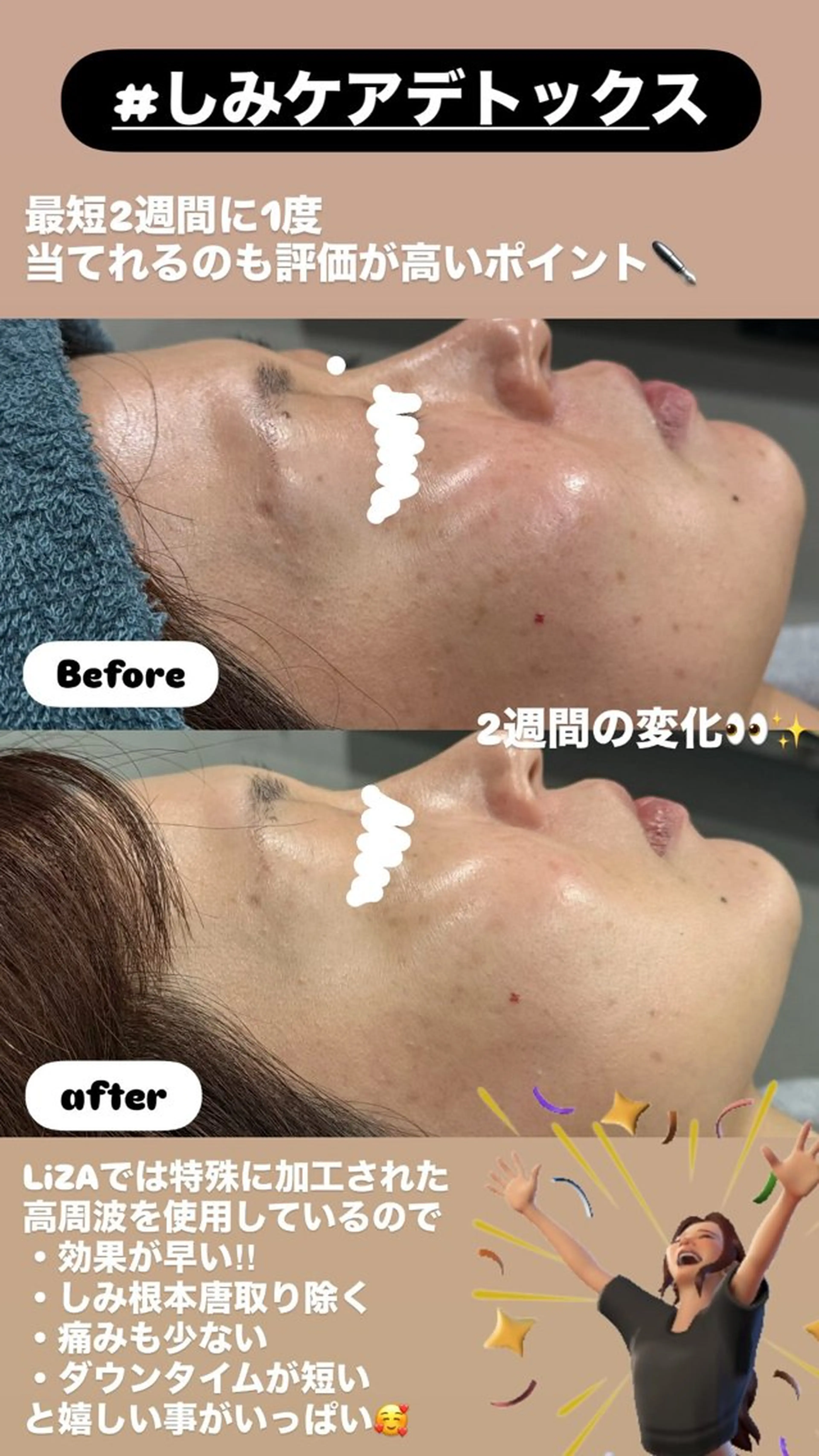 エステ LiZA エステティックサロンのエステ・リラクイメージ