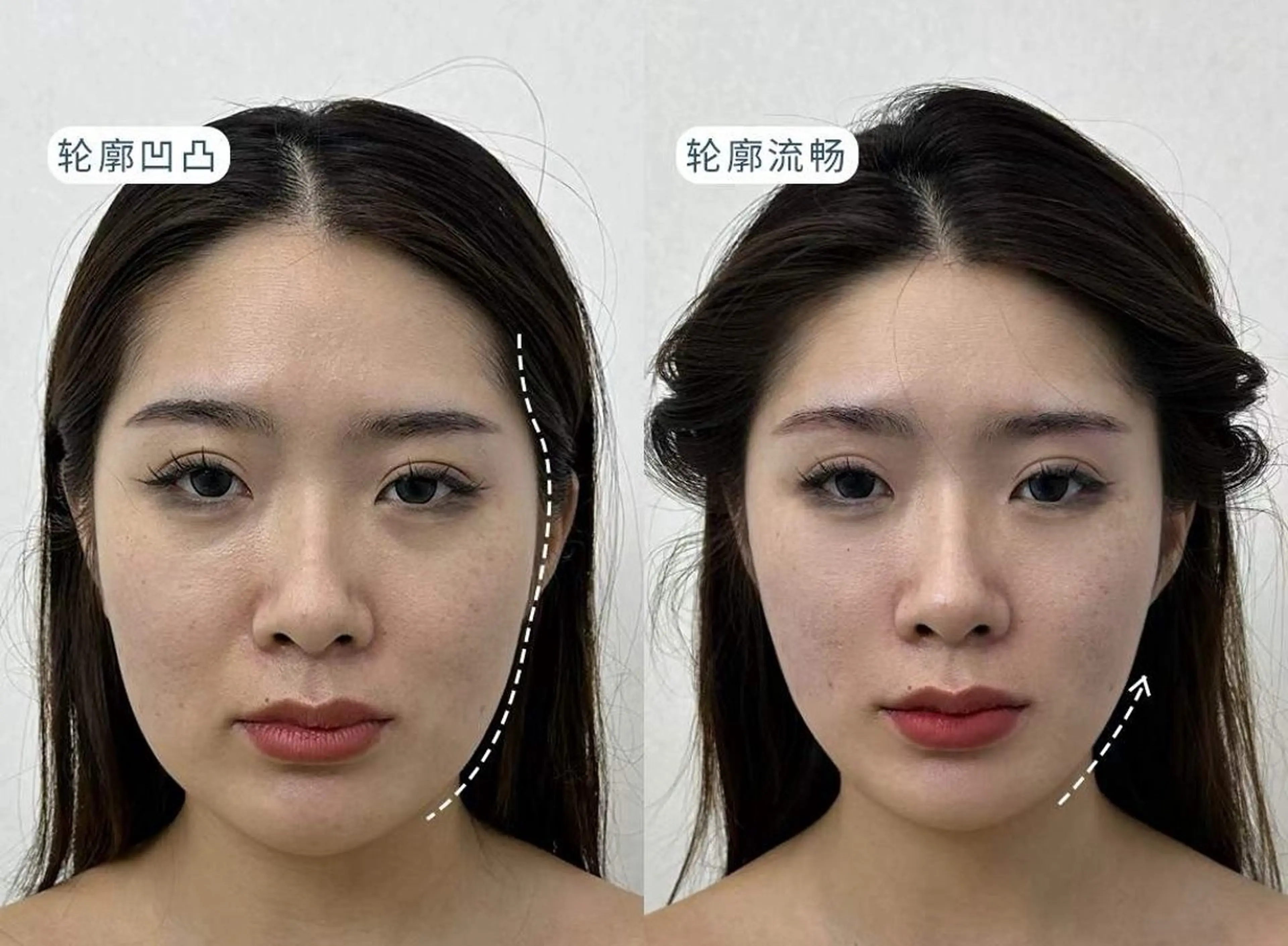 マツエク・マツパ エステ aliaハイフ&水光ジェットサロン所属・aliaハーブ水光店 エステティシャン募集のエステ・リラクイメージ