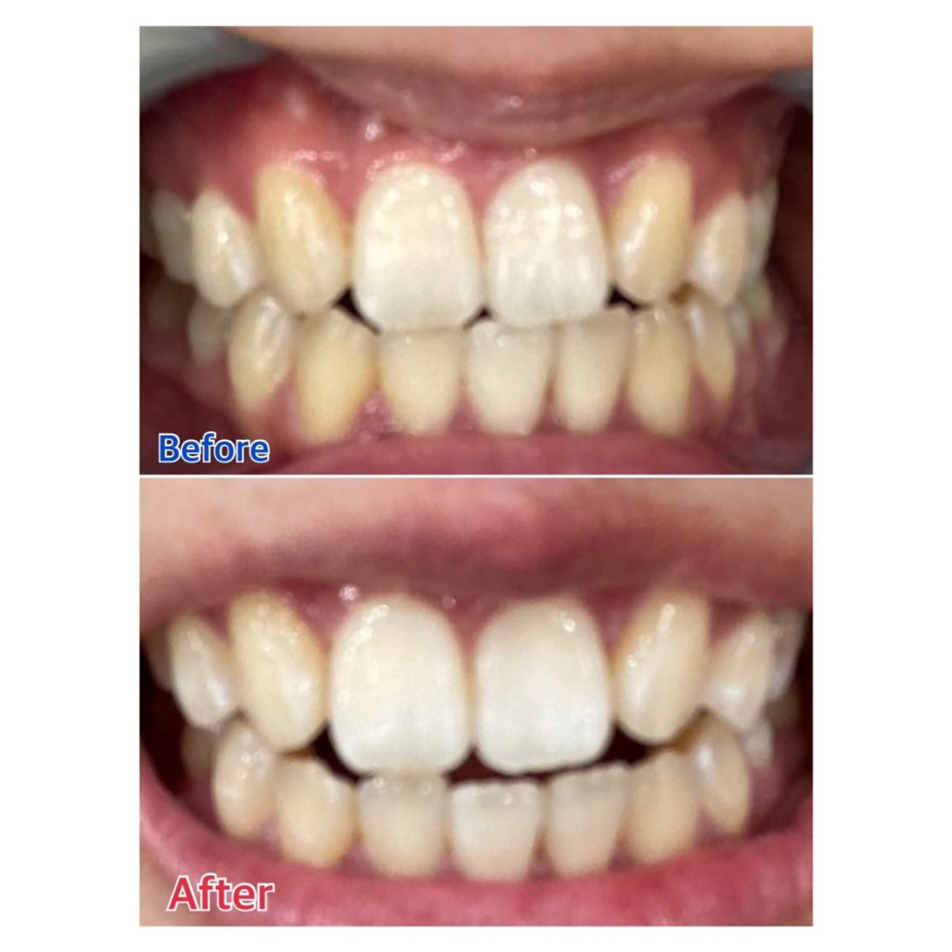 MBEAUTYSALON 千葉店・京成大久保所属・Melty 輝のその他イメージ