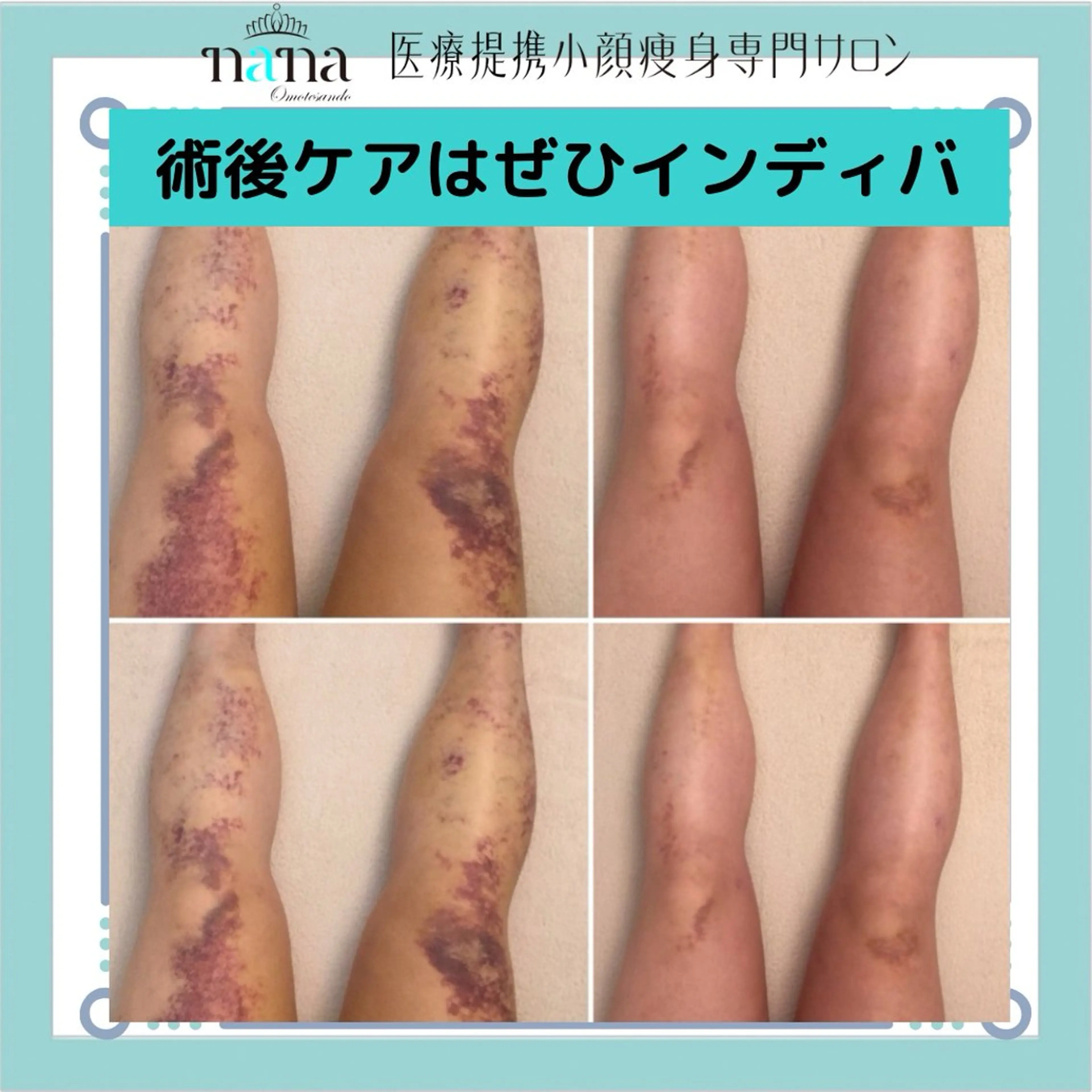 エステ リラク 小顔痩身インディバ Nana表参道のエステ・リラクイメージ