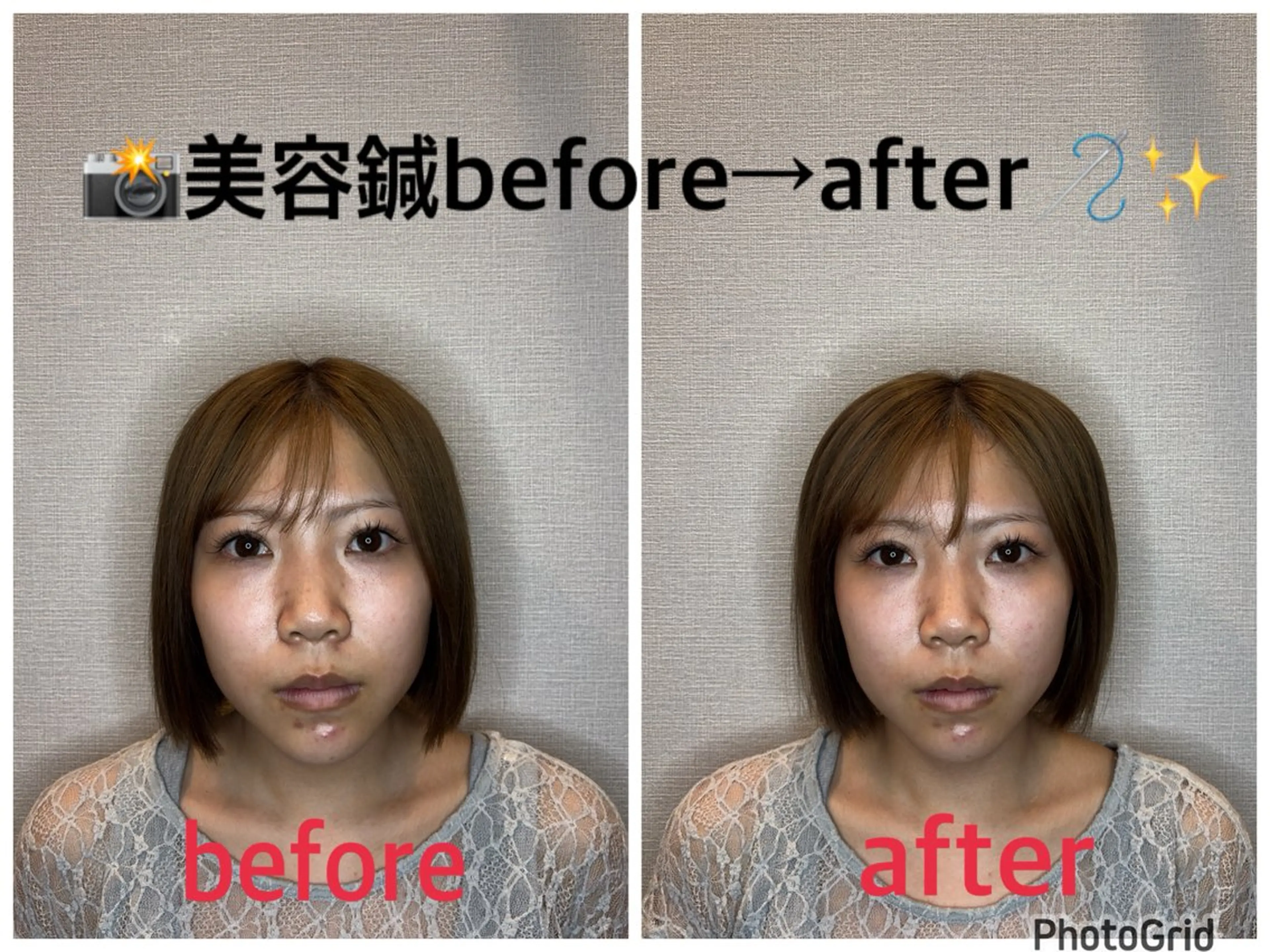 その他 小林整骨院本町 美容鍼roomのエステ・リラクイメージ