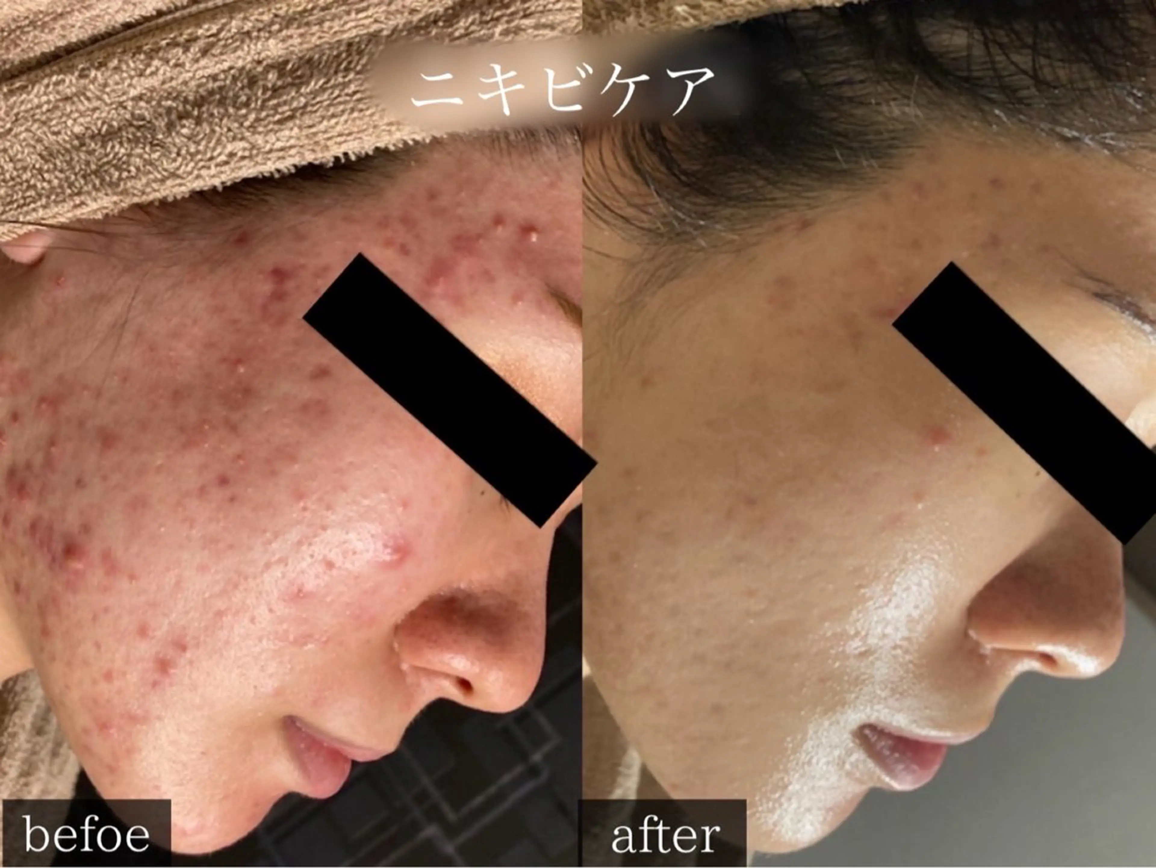 rejena 山口のエステ・リラクイメージ