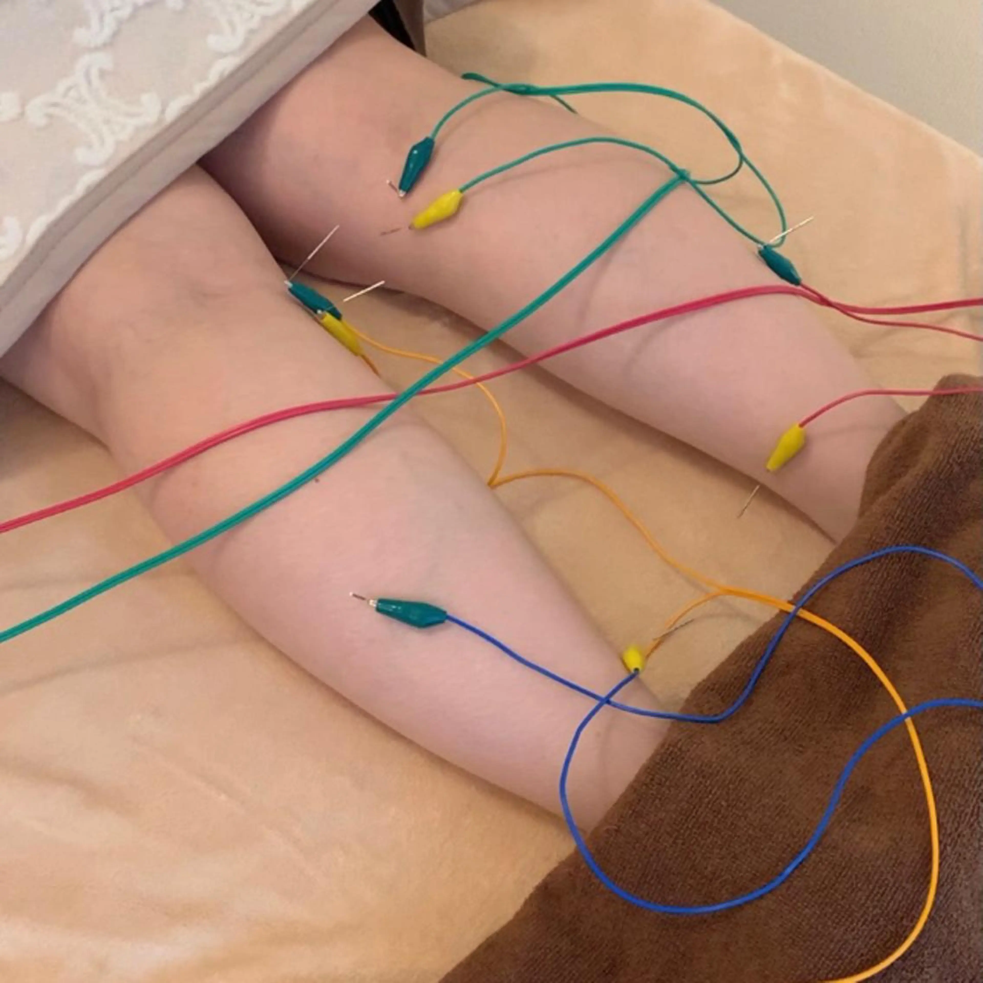 新宿hari-me所属・美容鍼hari-me 新宿のエステ・リラクイメージ