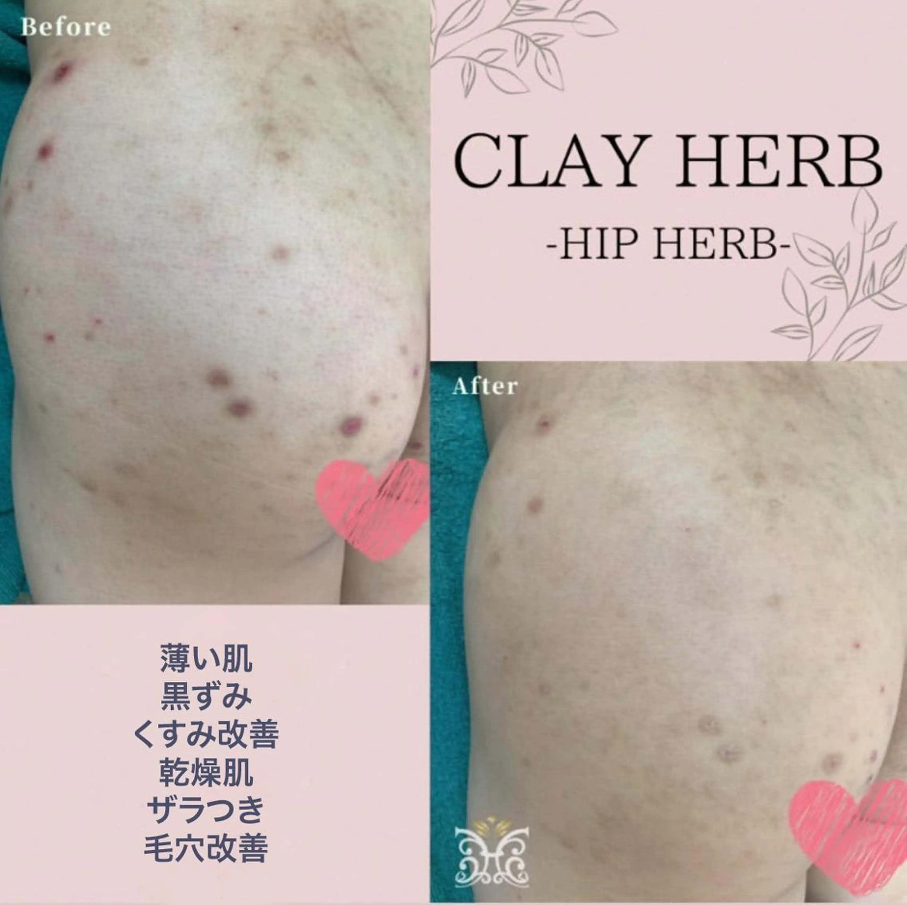 美肌&アロマ🌙 nana 目白/池袋のエステ・リラクイメージ