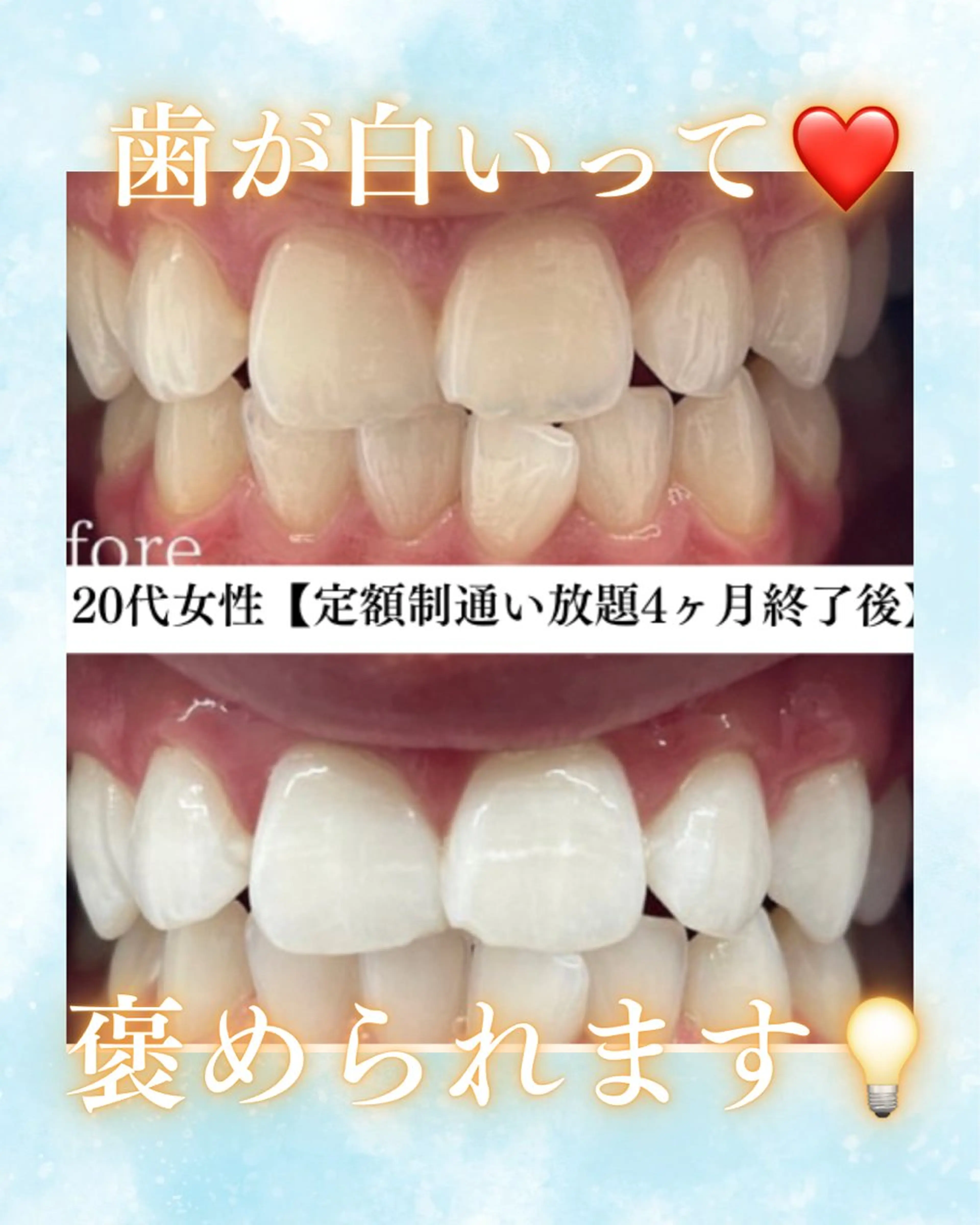 メンズ その他 ホワイトニング専門店 WHITE天神店のエステ・リラクイメージ