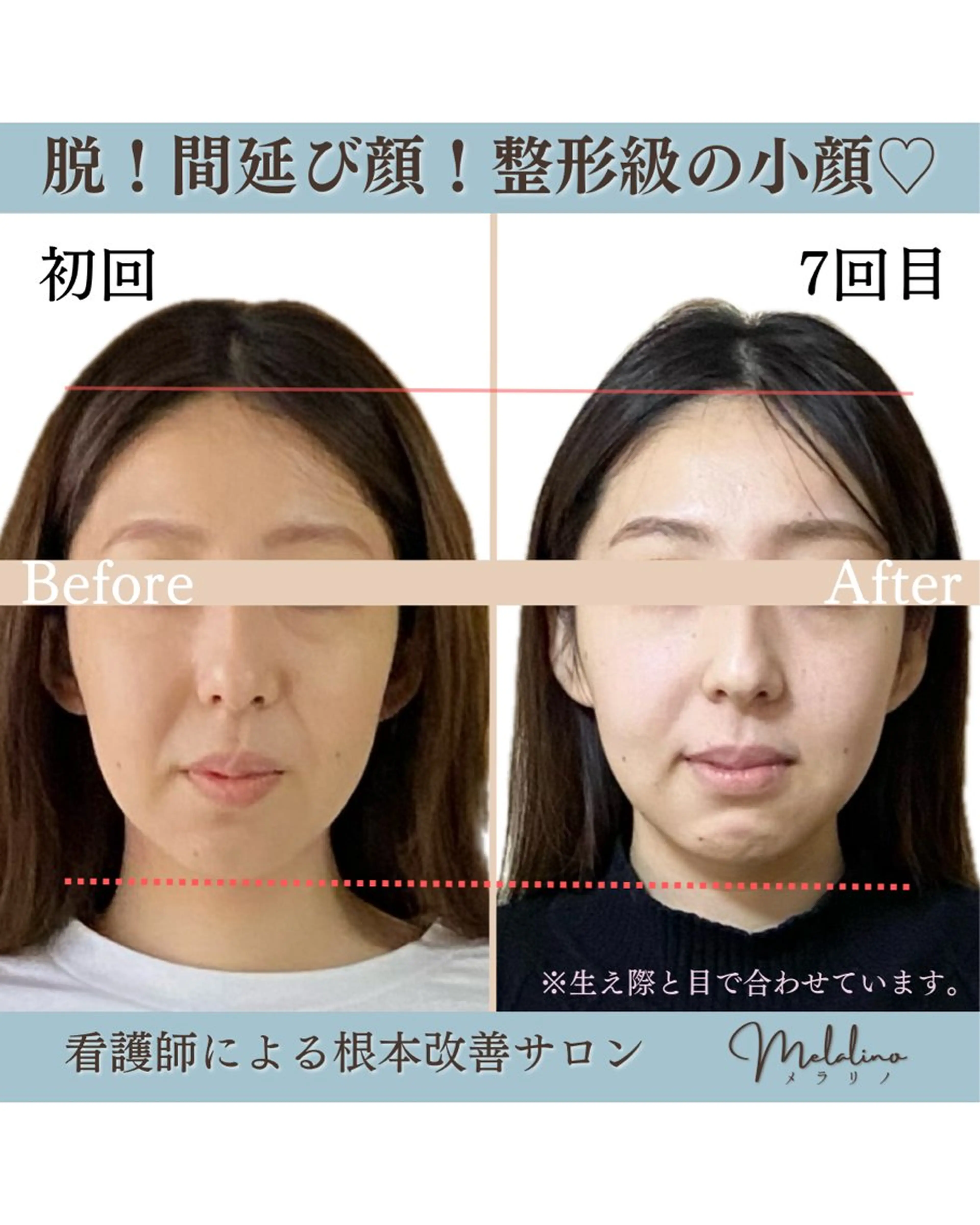 【小顔・たるみ🧏🏼‍♀️】全身＋小顔整顔120分（カウンセリング込み）の写真