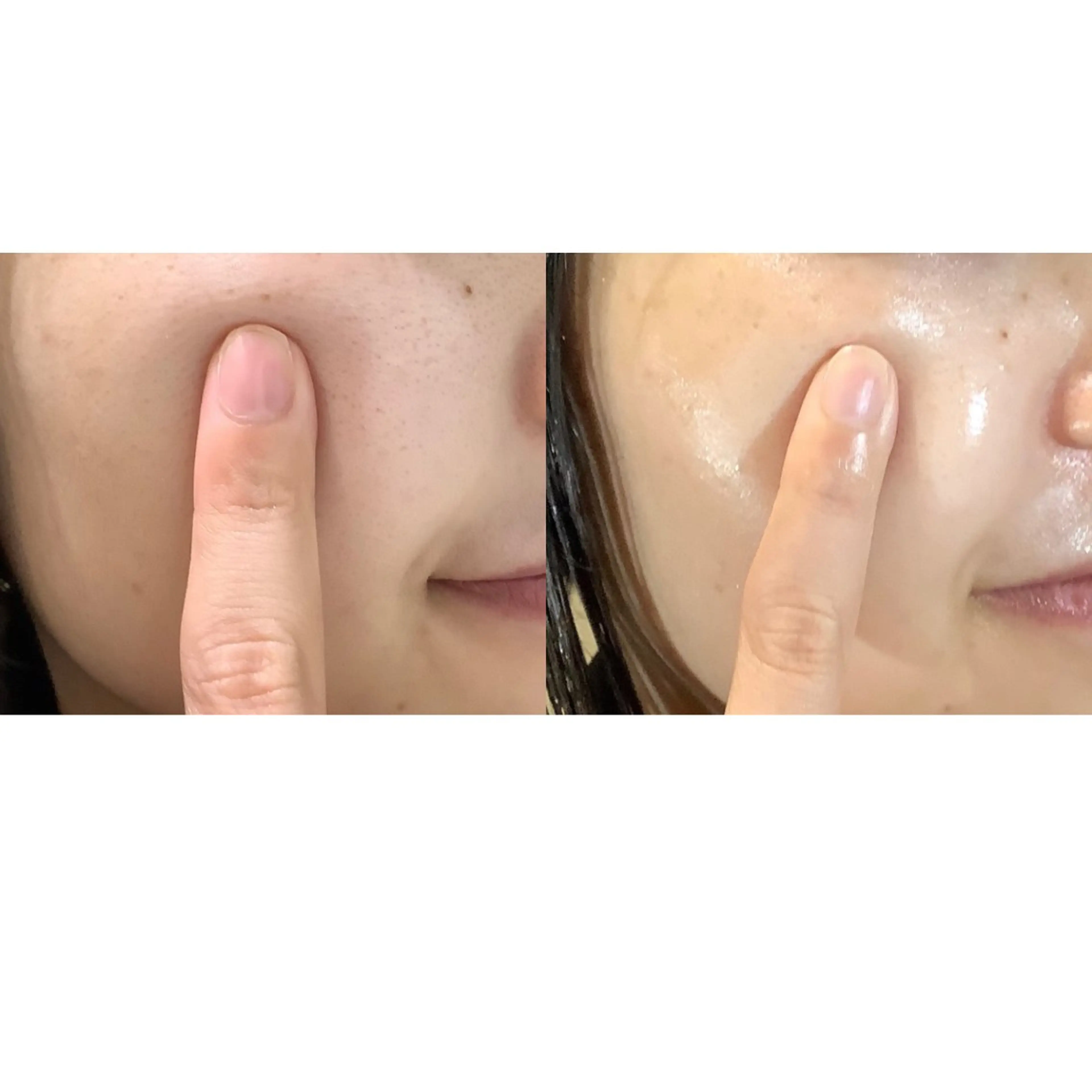 MORE BEAUTY ESTHE 本通り店所属・【シミ・シワ専門店】 山本 藍美のエステ・リラクイメージ